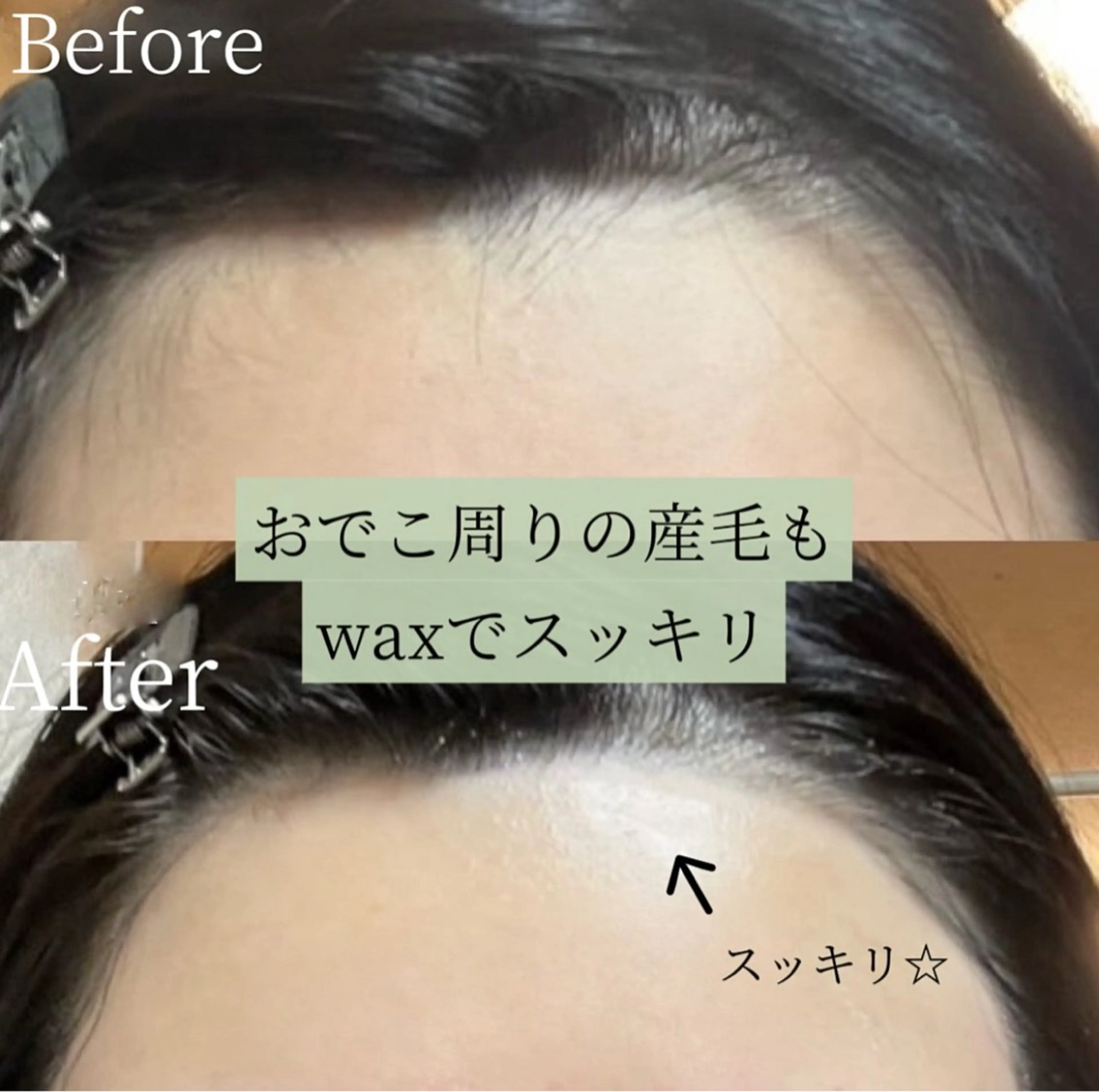 全顔ワックス(眉毛+おでこ+もみあげデザイン込み)の写真