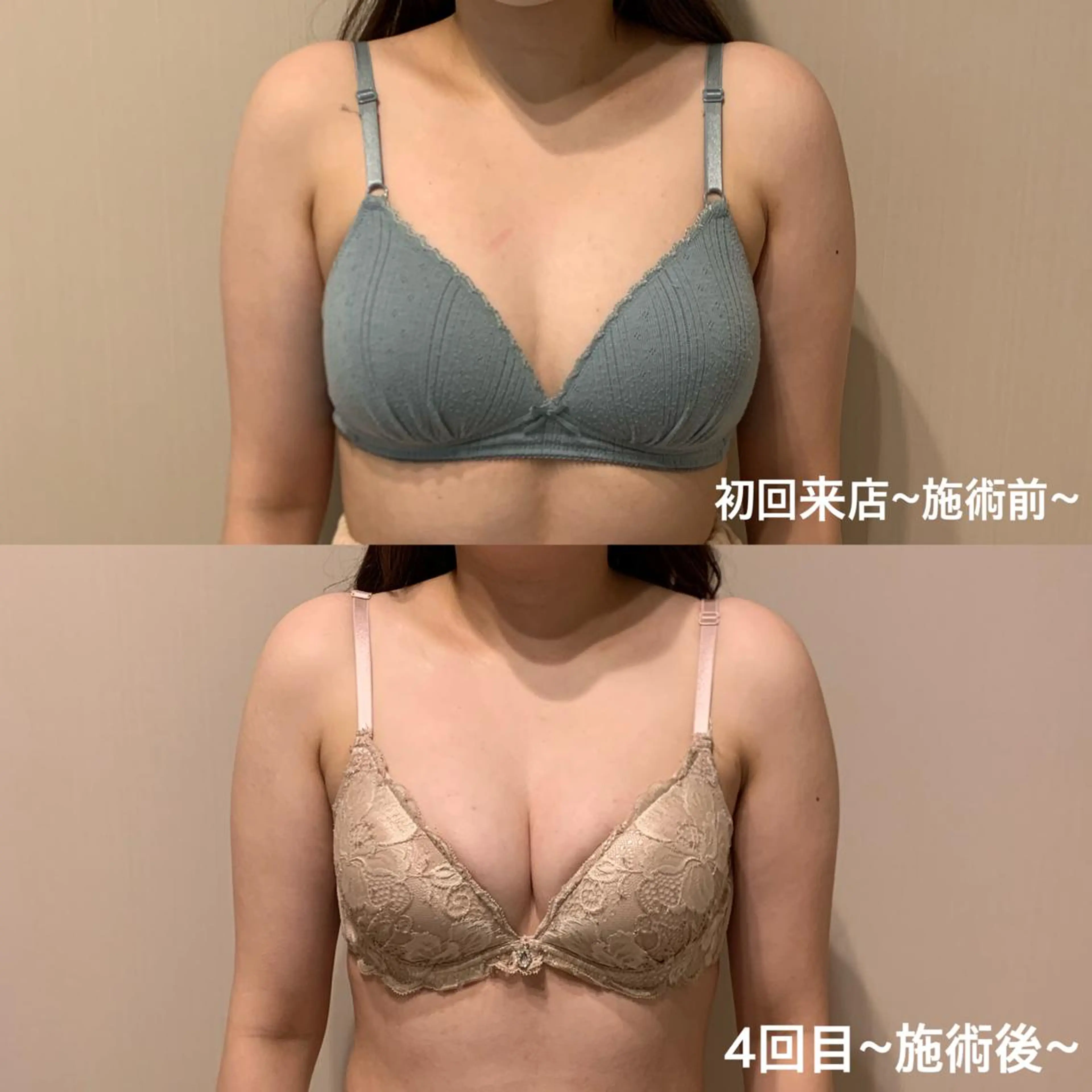 【背面含むバストケアで全身整うひと時】お背中と足元からのケアで根本改善を目指します！最新機器で驚きの効果と筋膜リリース♪の写真