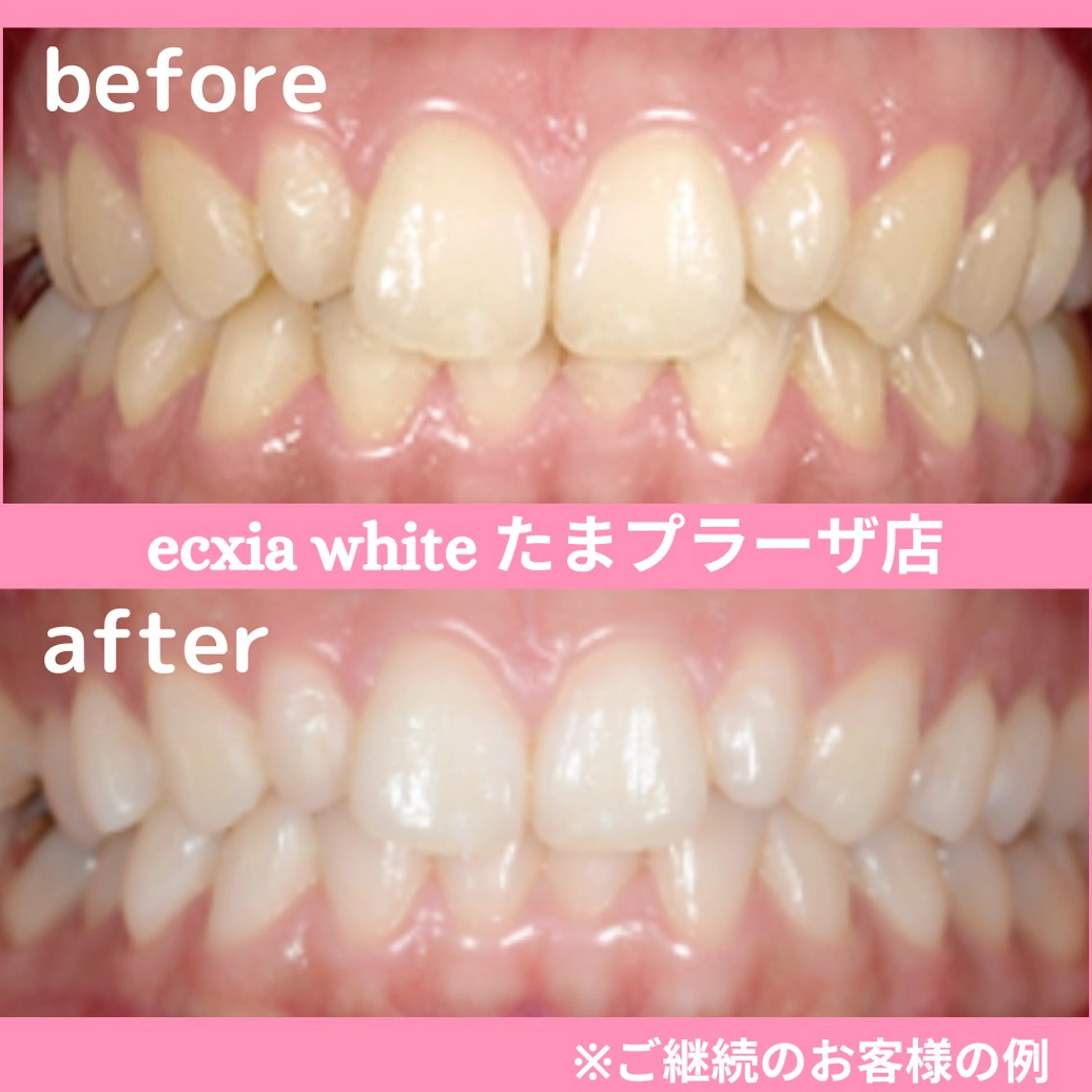 セルフホワイトニング　エクシアたまプラーザ店所属・セルフホワイトニング エクシアたまプラーザのその他イメージ