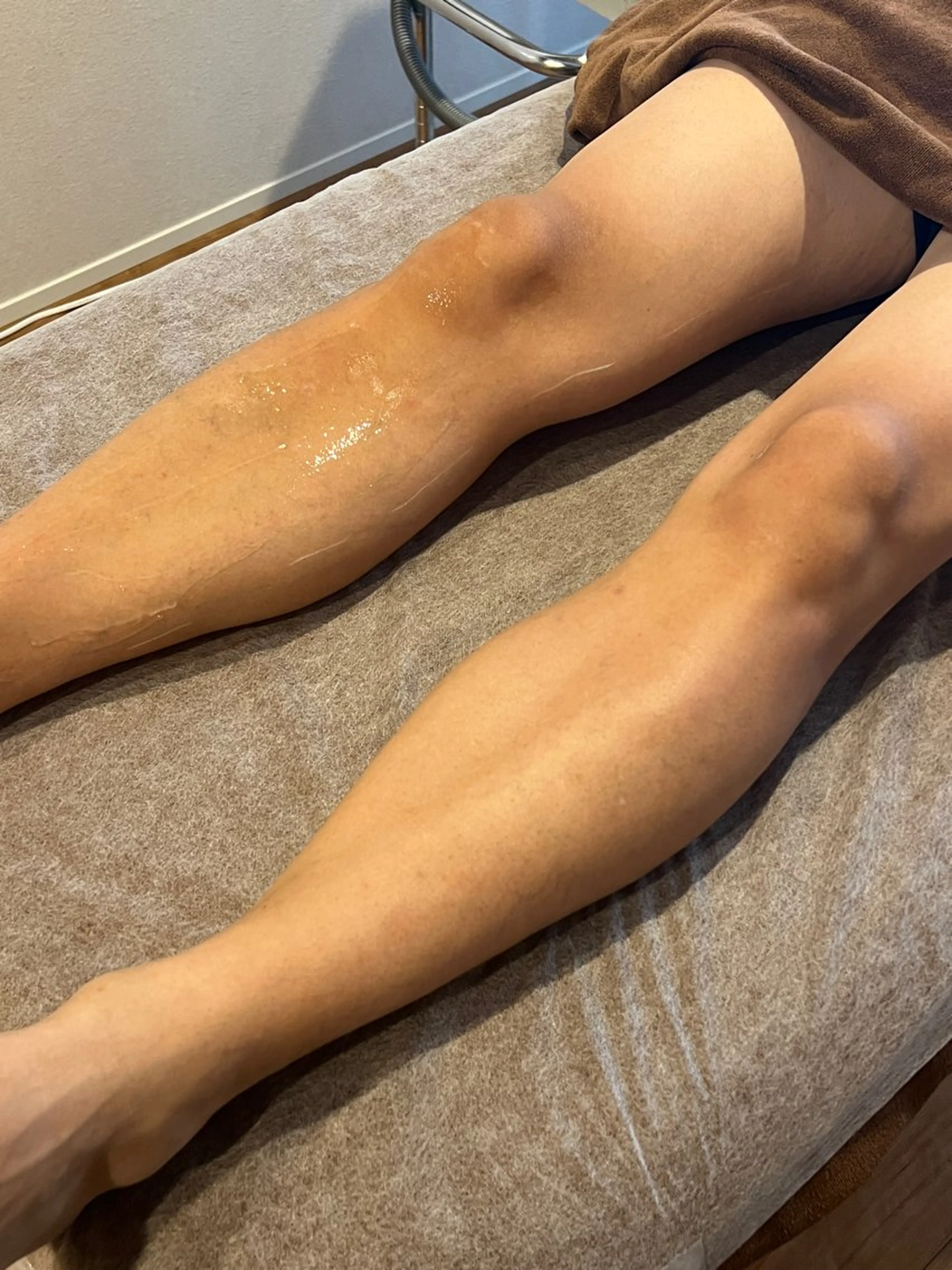 脱毛 脱毛サロンat ikaw下北沢所属・at ikawのエステ・リラクイメージ