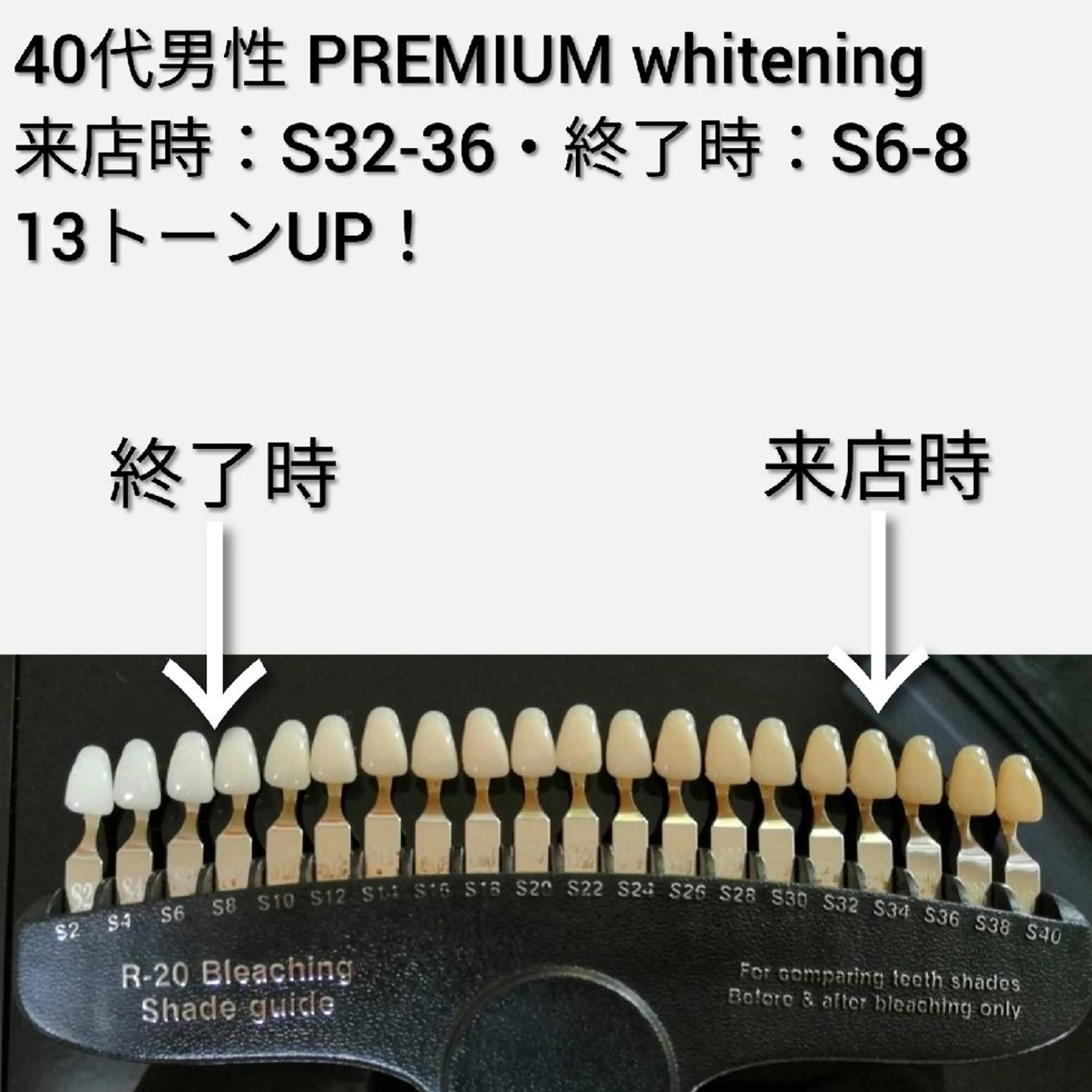 メンズ 美歯口工房セルフホワイトニングMilky所属・竜沢 佳典のエステ・リラクイメージ