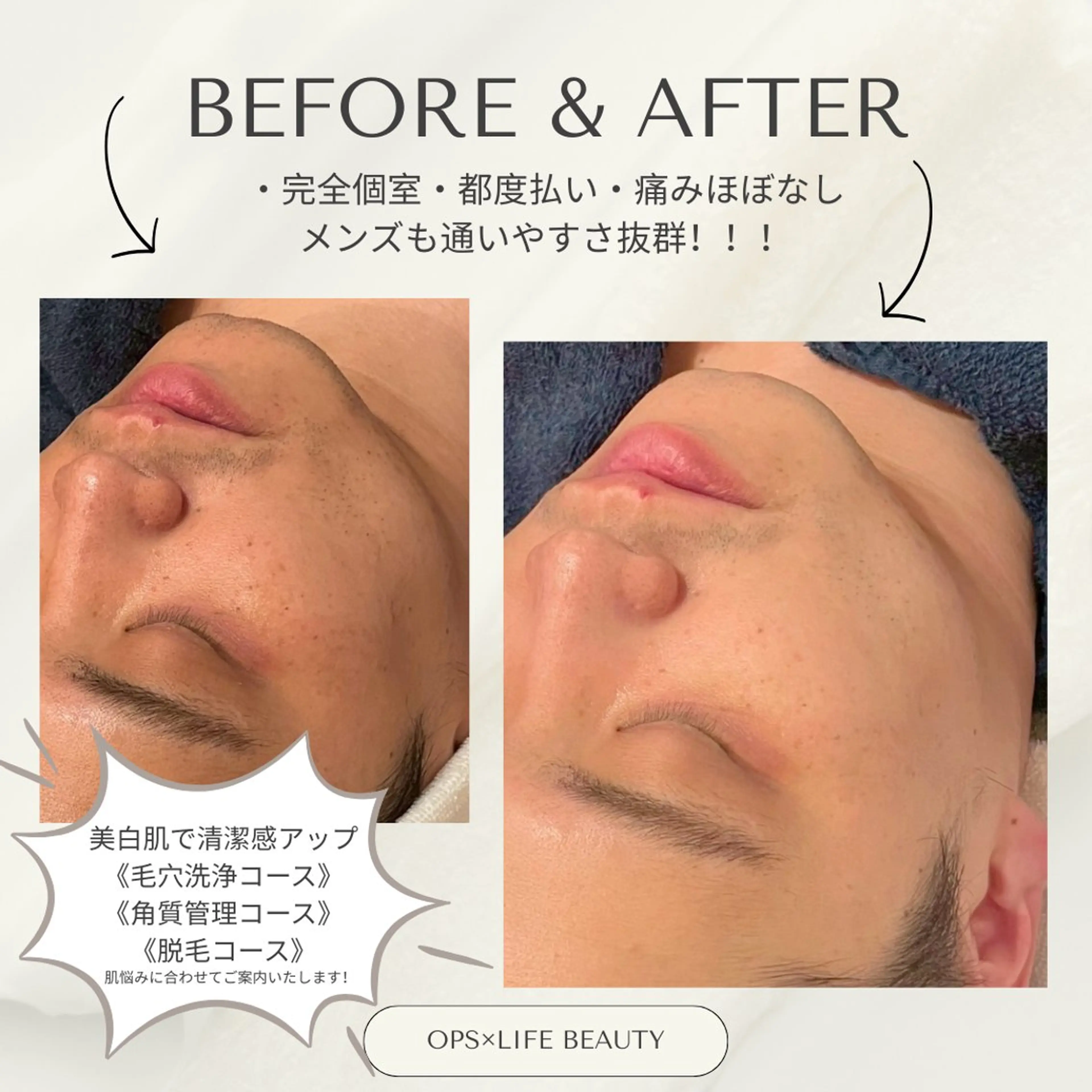 メンズ ビジネス OPS×LIFE BEAUTY/maiのエステ・リラクイメージ