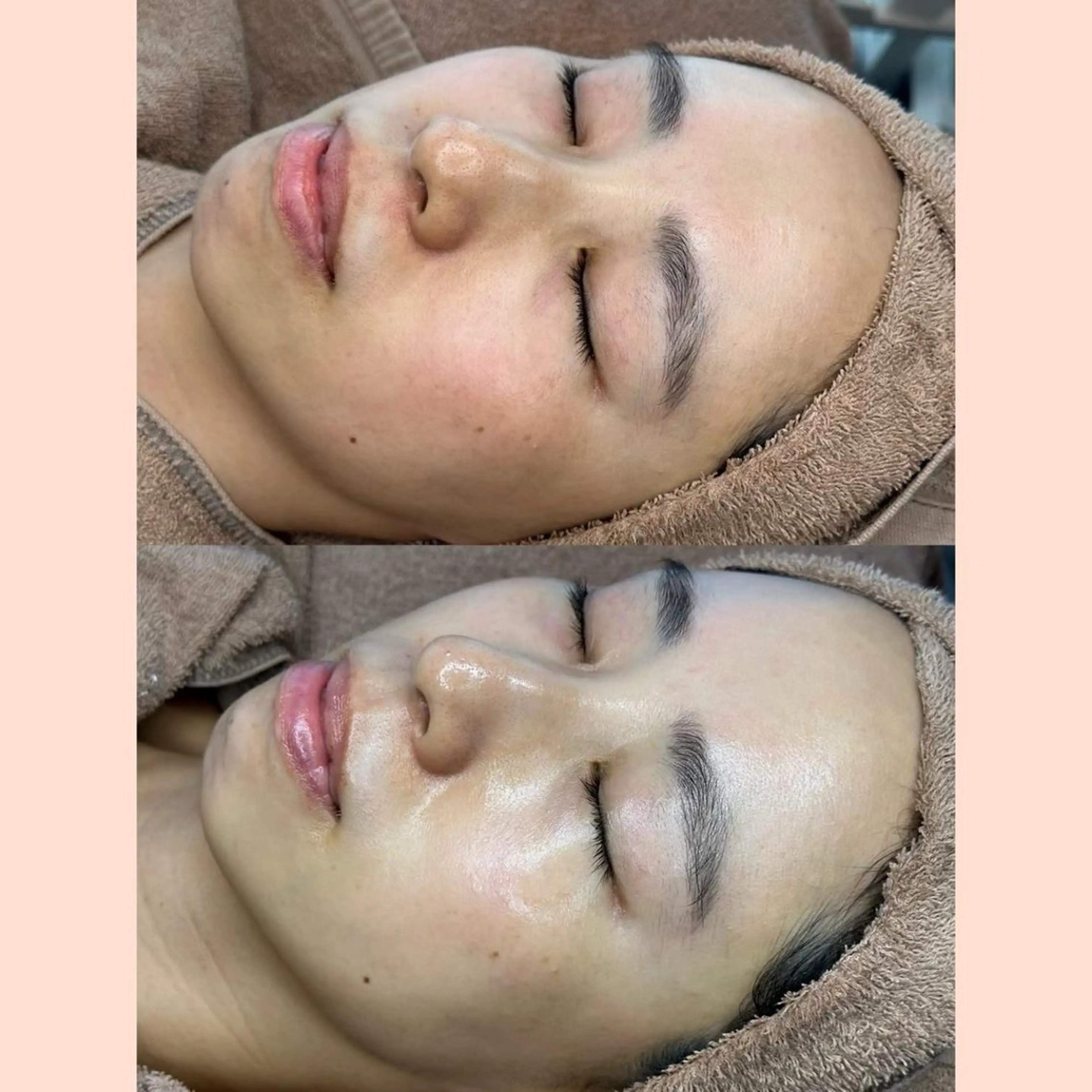 韓国発次世代ピーリング🫧ララピールの写真