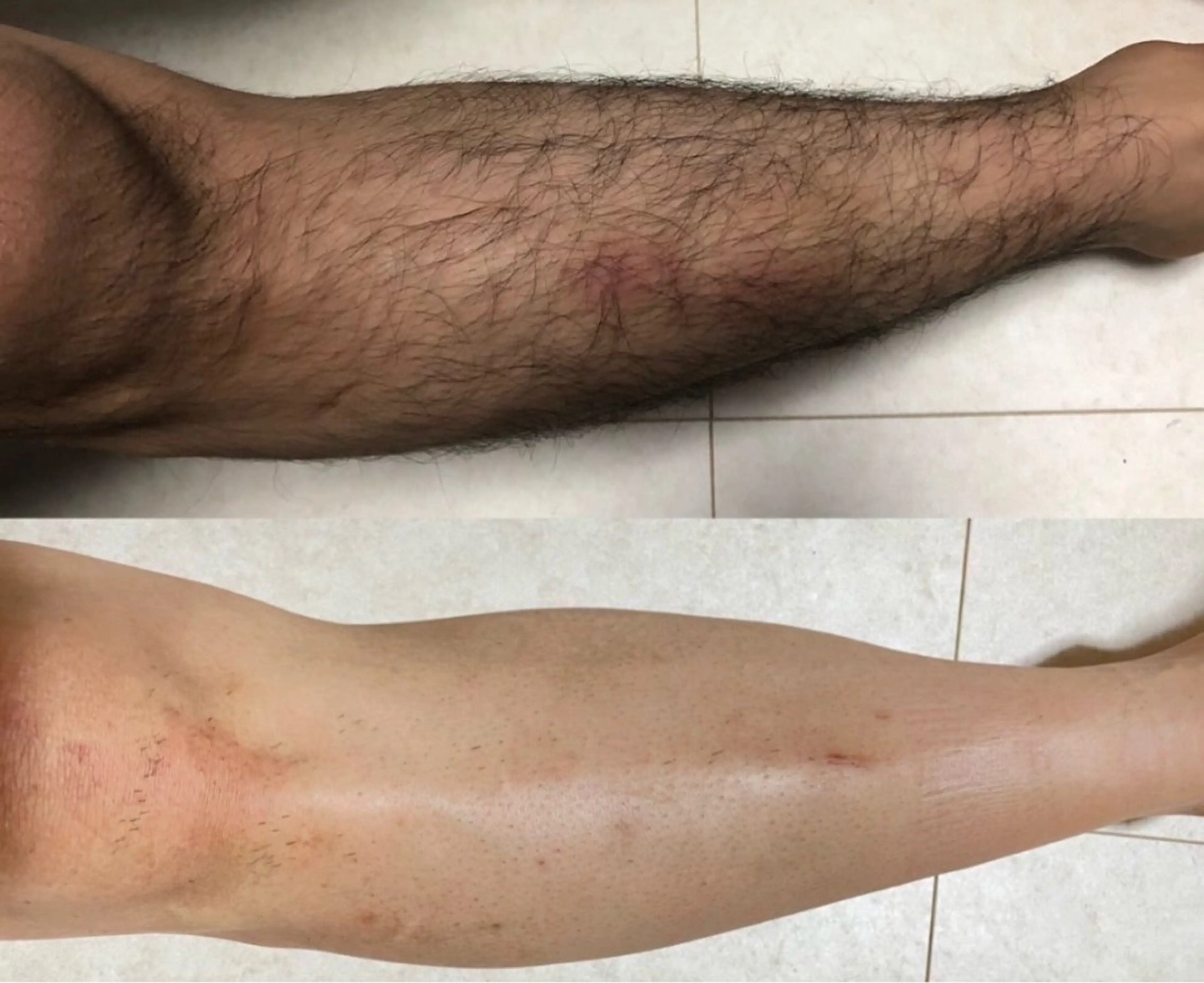 メンズ 脱毛 Neosalon所属・Neosalon ネオサロンのエステ・リラクイメージ