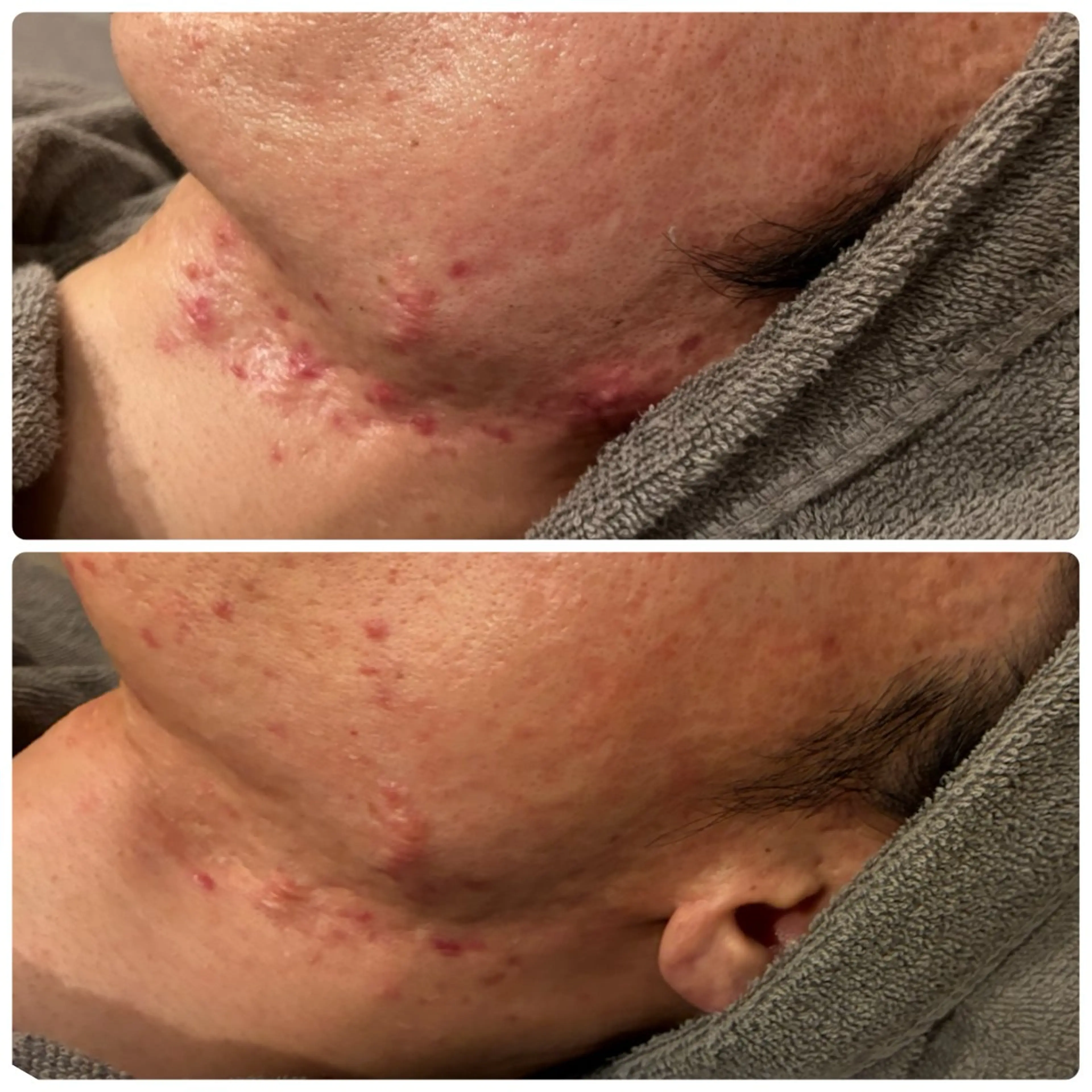 脱毛 yellow.所属・yellow💛【 脱毛&フェイシャル】のエステ・リラクイメージ