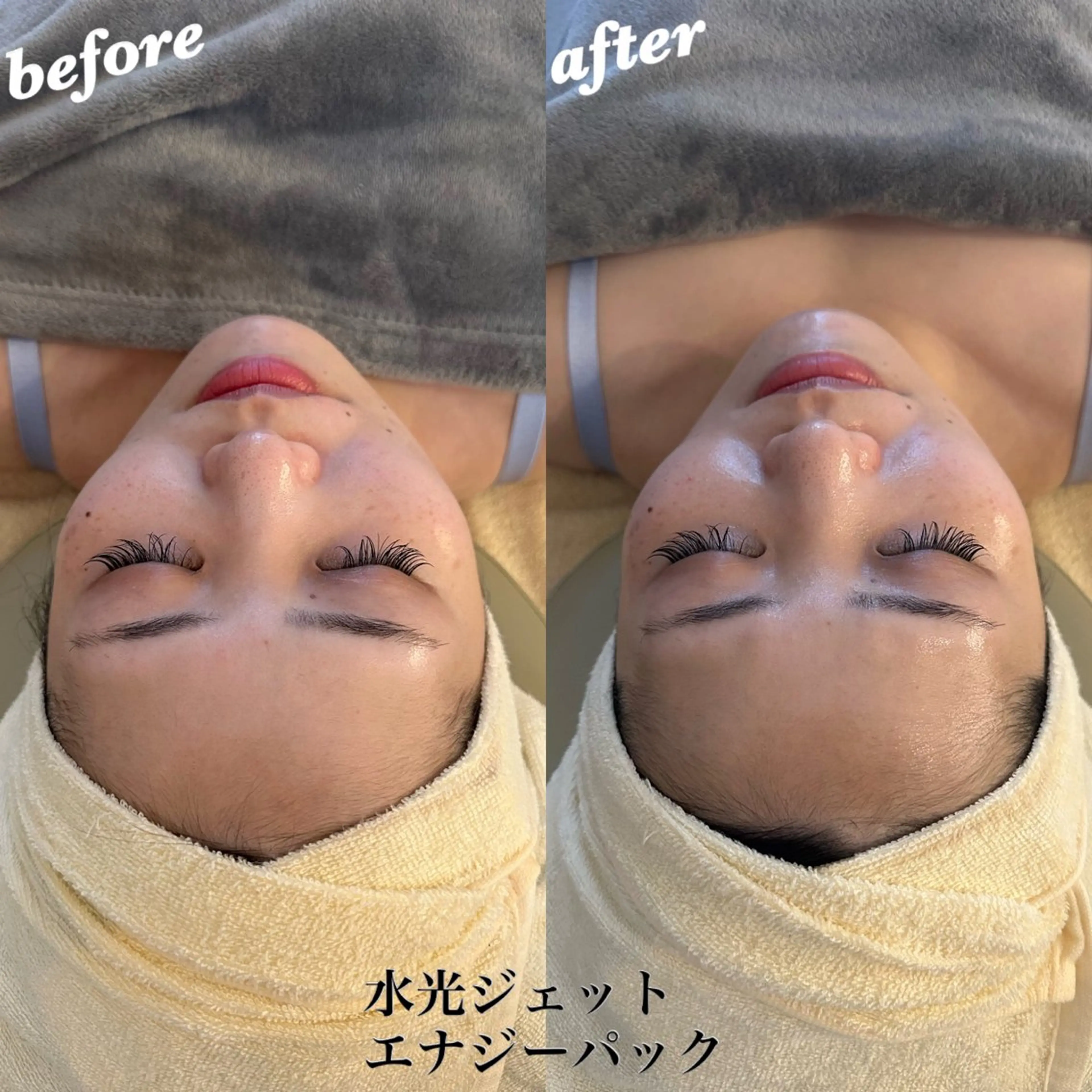 エステ うなじ脱毛/美肌脱毛 LABELのエステ・リラクイメージ