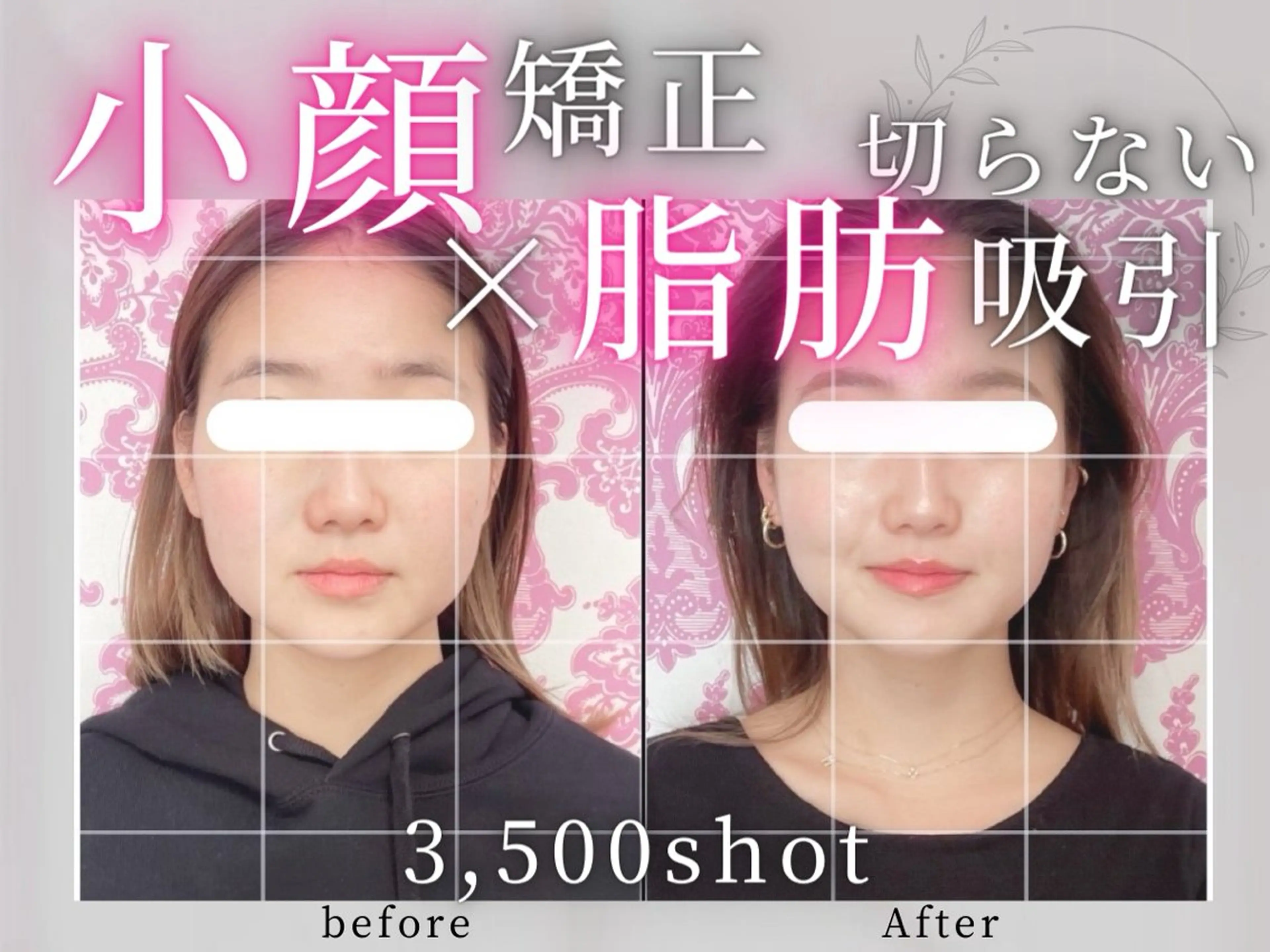 小顔矯正専門店 【RED】池田のエステ・リラクイメージ