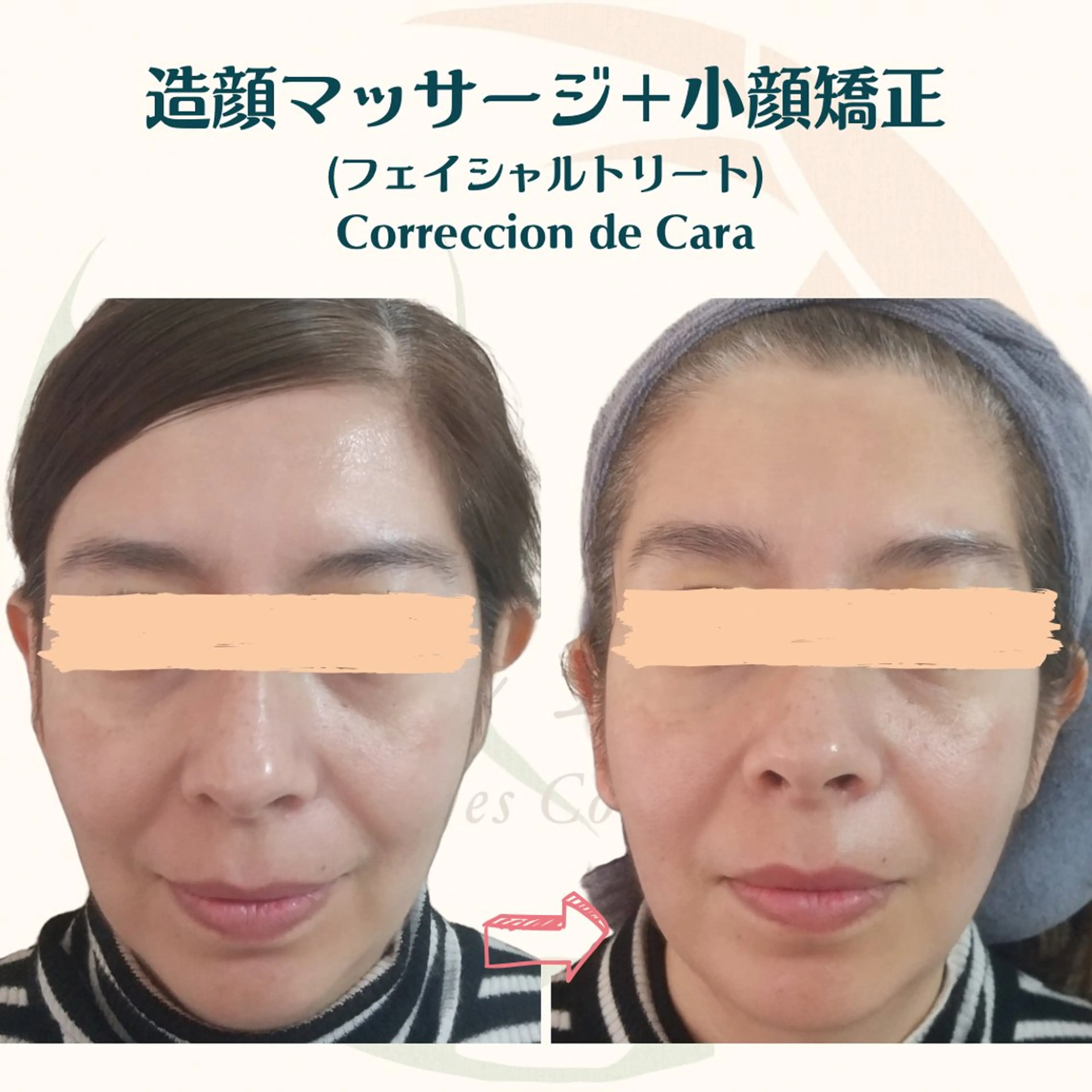 小顔矯正☀︎バスト ☀︎ハルのエステ・リラクイメージ