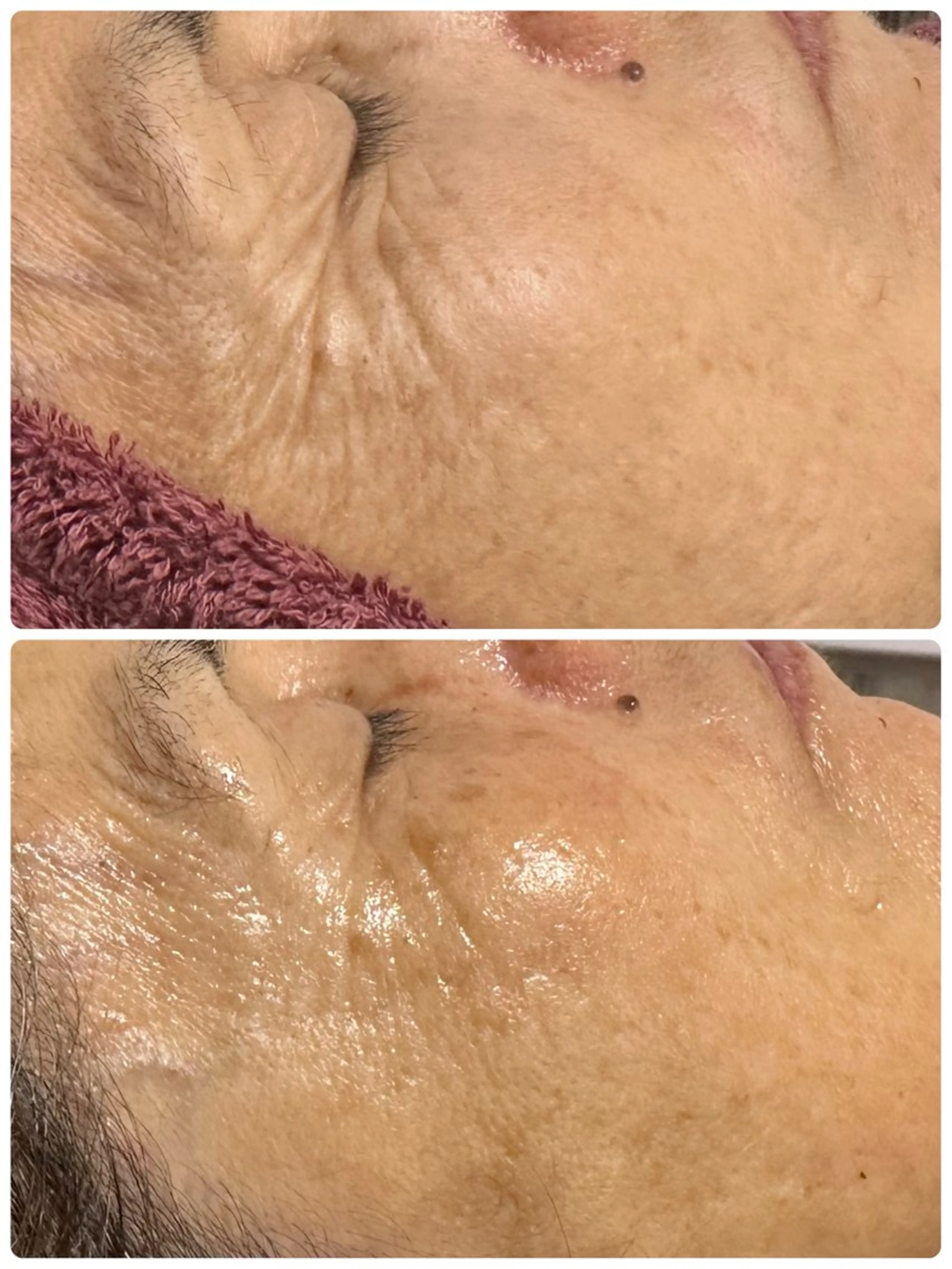 エステ 越猪 未来のネイルデザイン