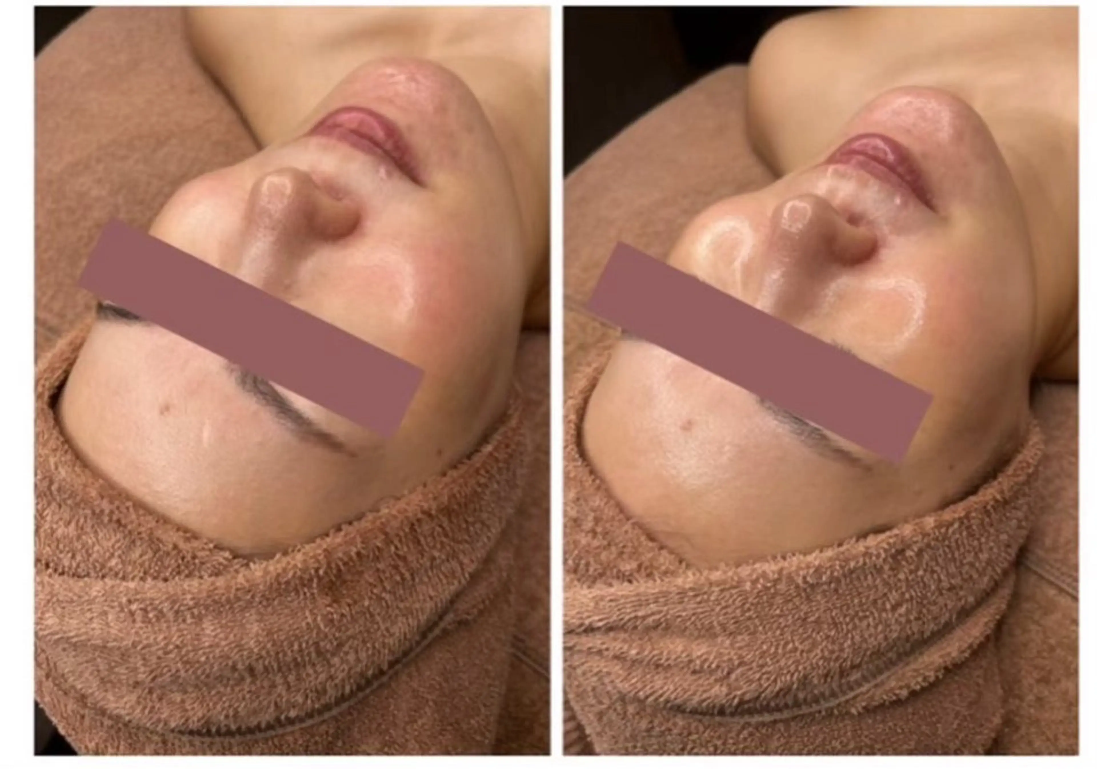 STELLA トータルビューティーのその他イメージ