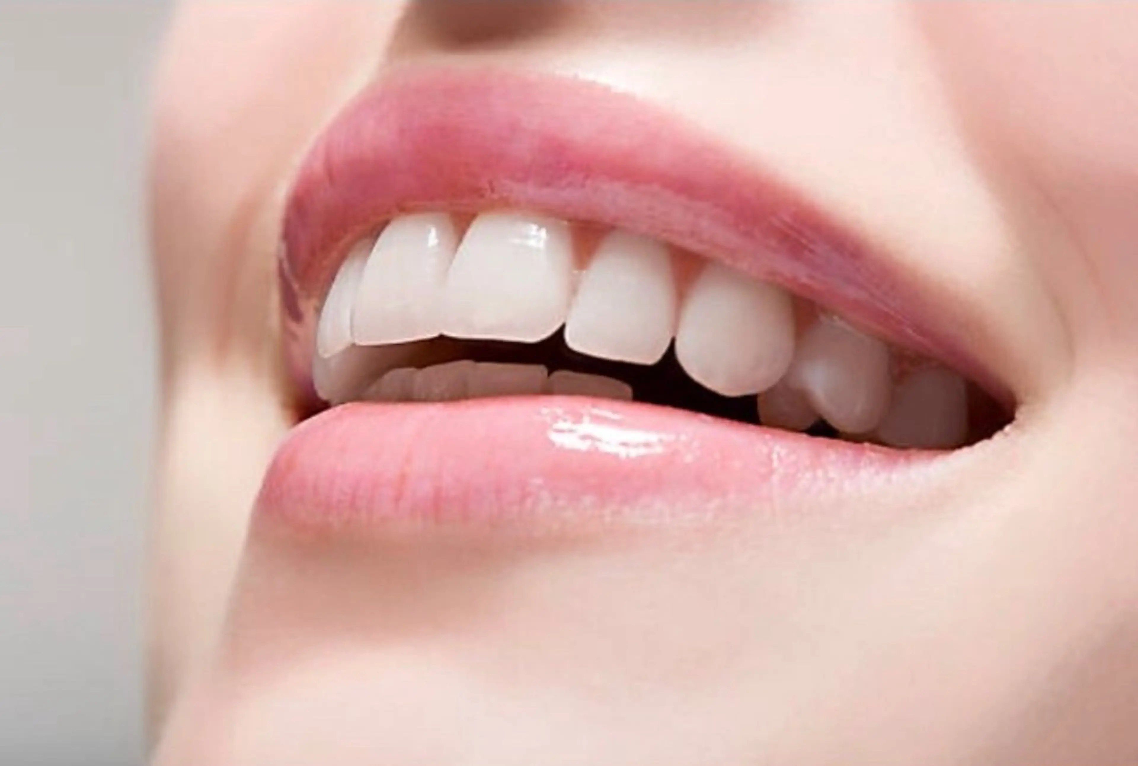 【高い効果を実感◎ロング照射】プレミアムセルフホワイトニング　40分照射の写真