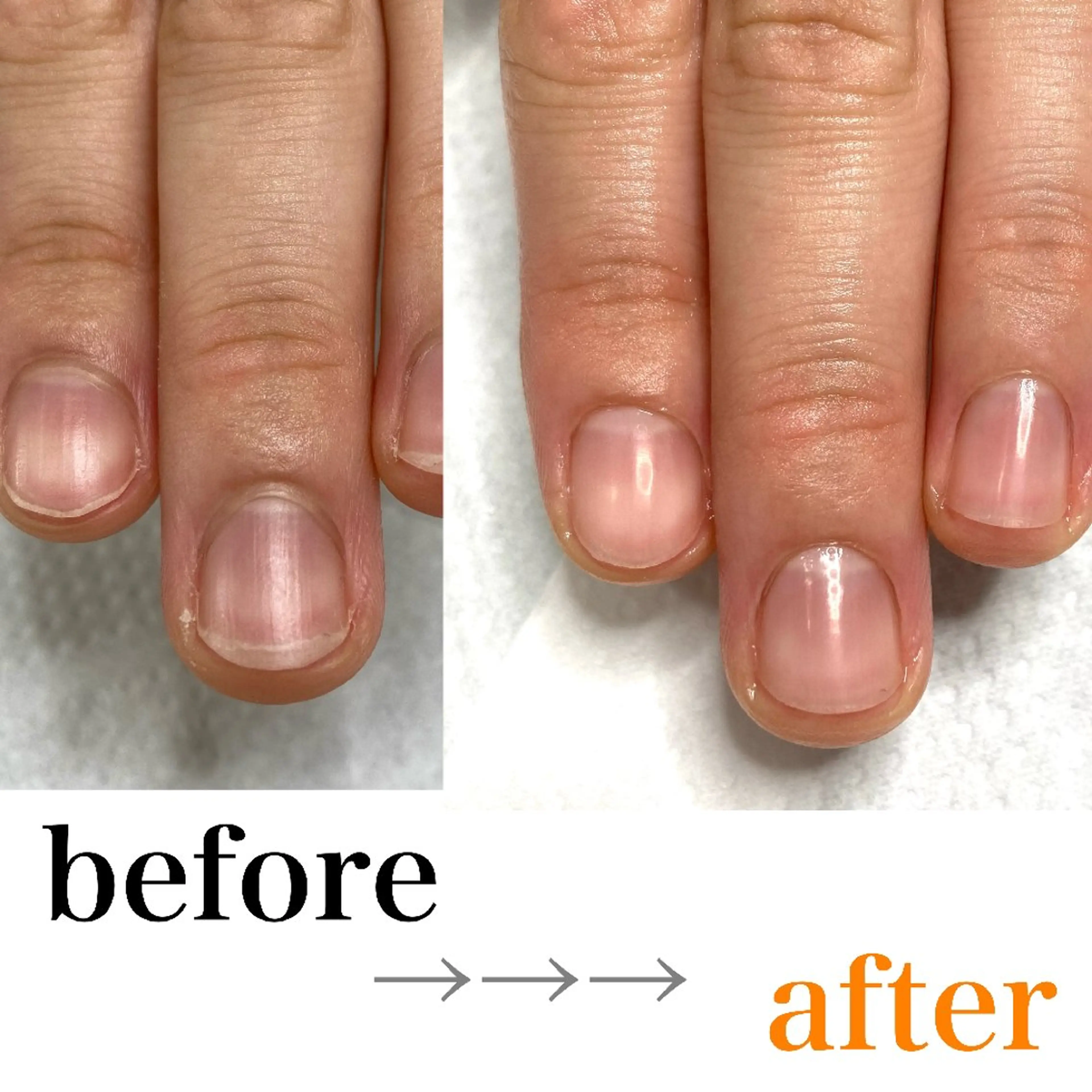 ハンドケアの写真