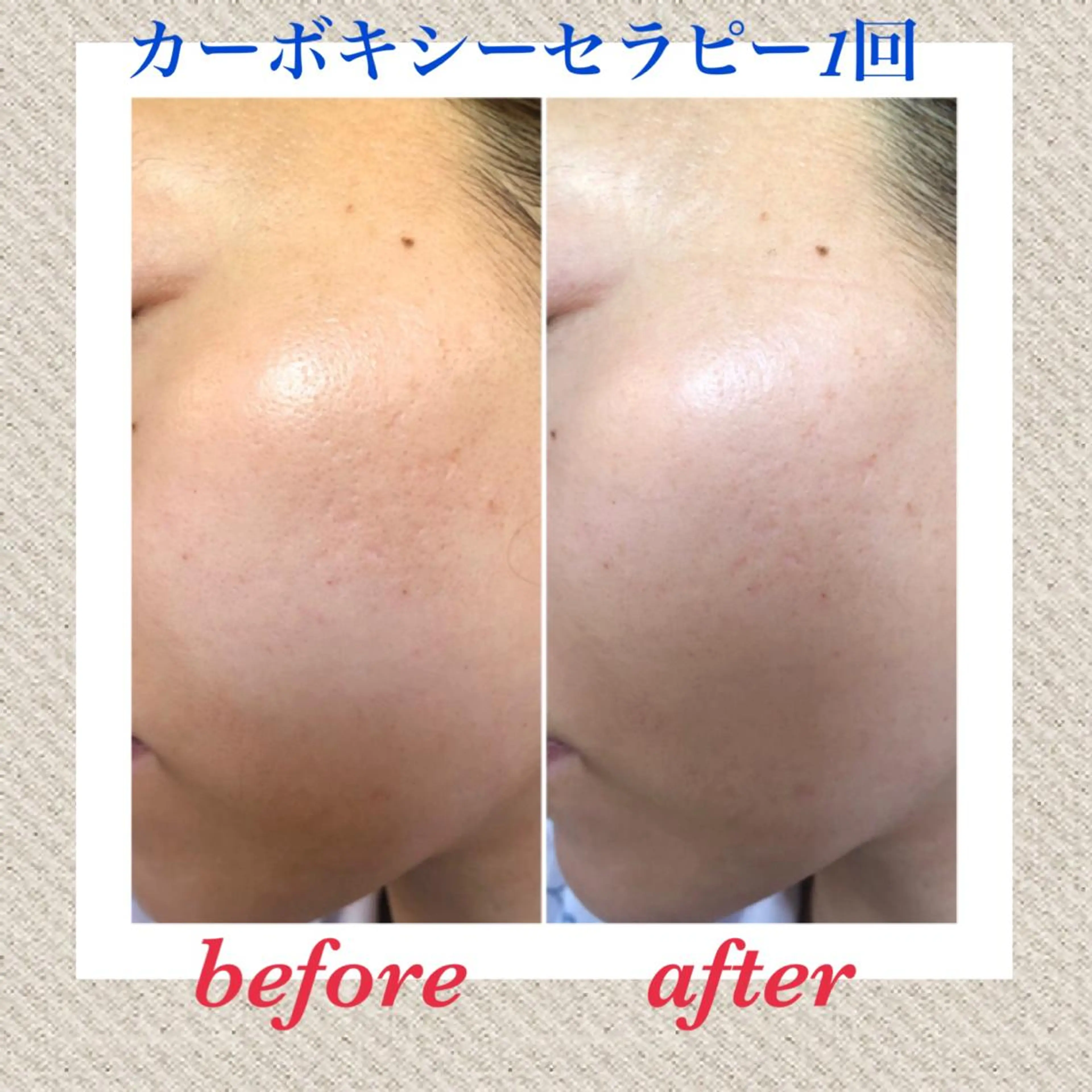 美ola ビオラのエステ・リラクイメージ