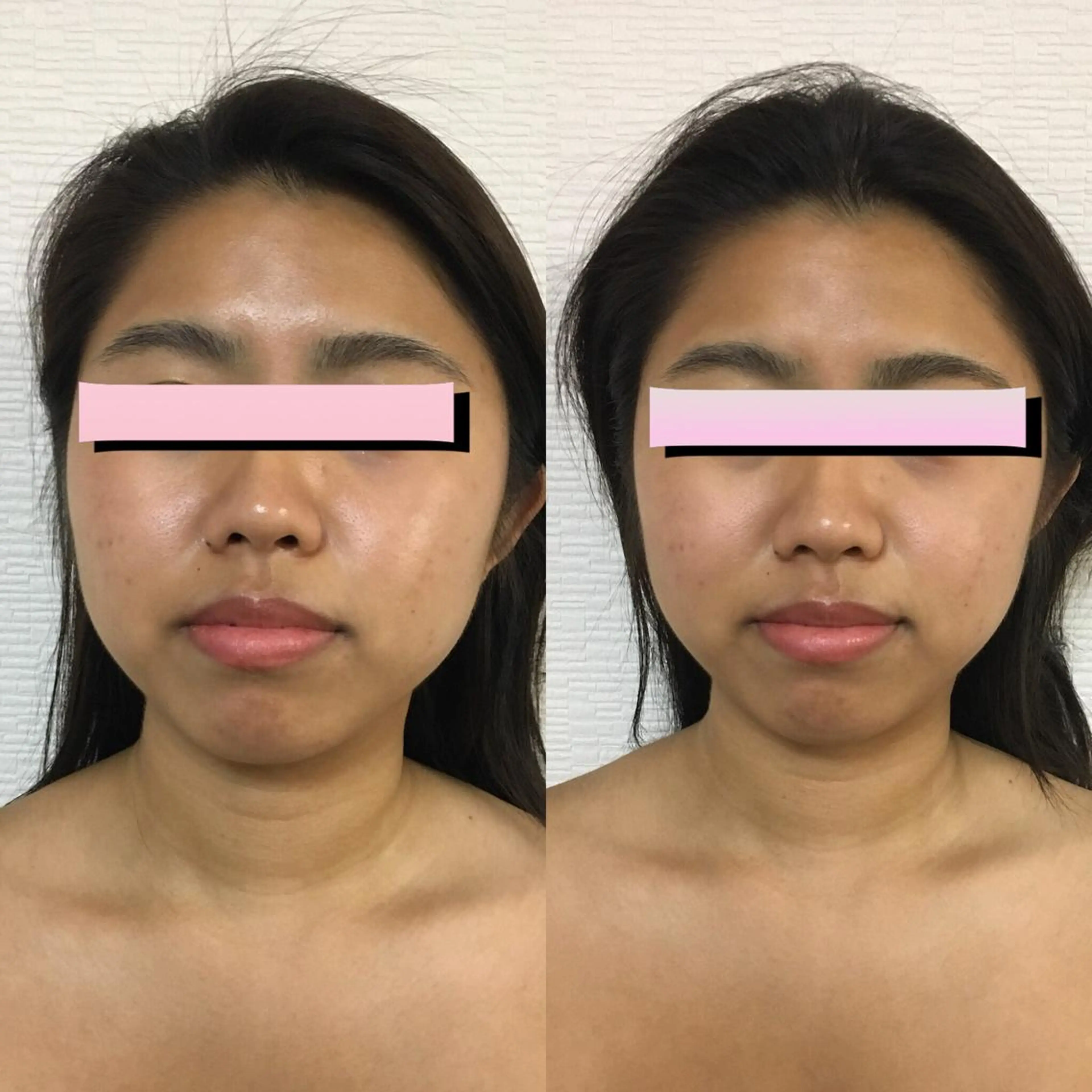 小顔筋膜矯正サロン桜Biscuit~サクラビスケット~所属・小顔/肩こり/脱毛 桜Bisucuitのエステ・リラクイメージ