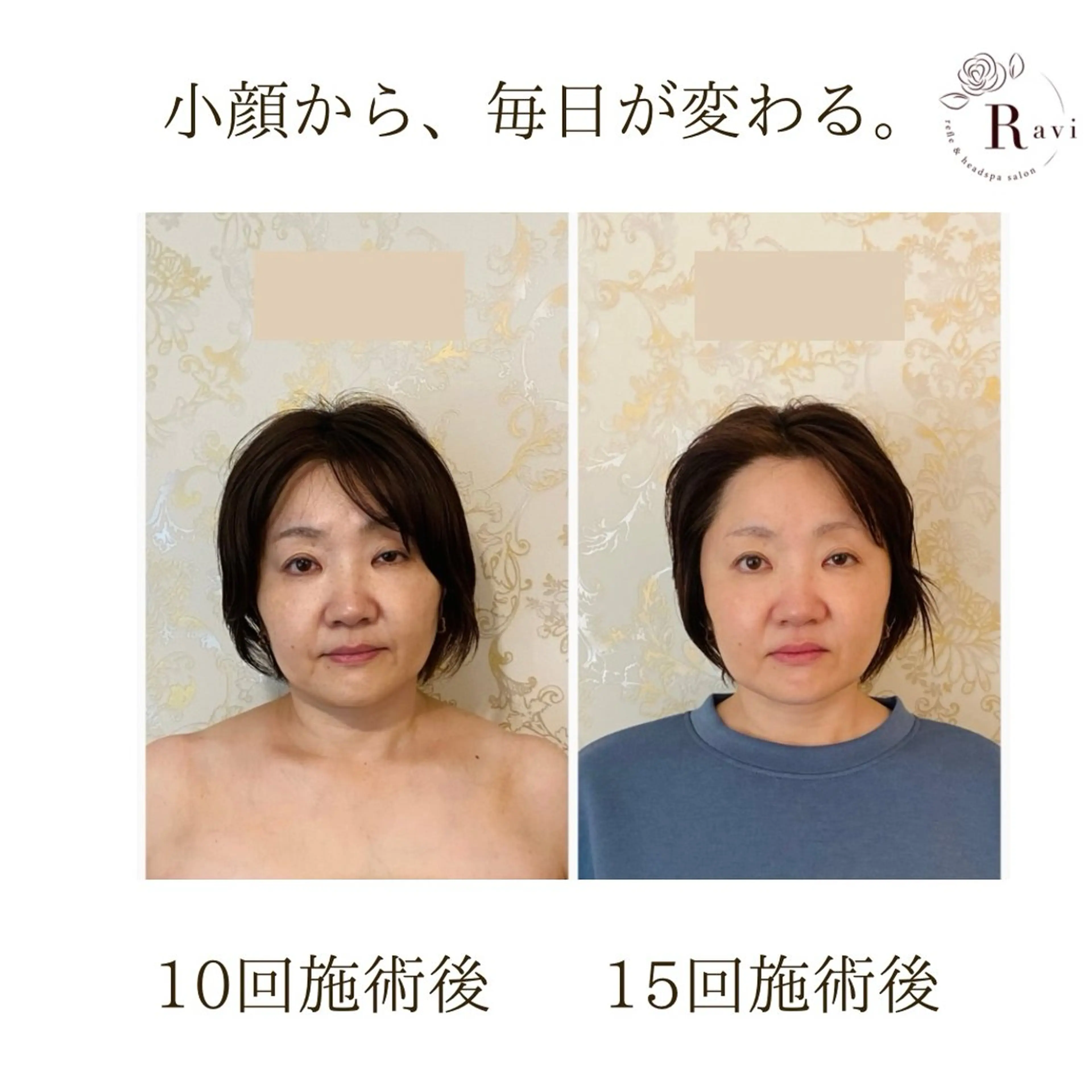 小顔サロンラヴィ　　船橋馬込沢店所属・小顔サロンラヴィ 船橋のエステ・リラクイメージ