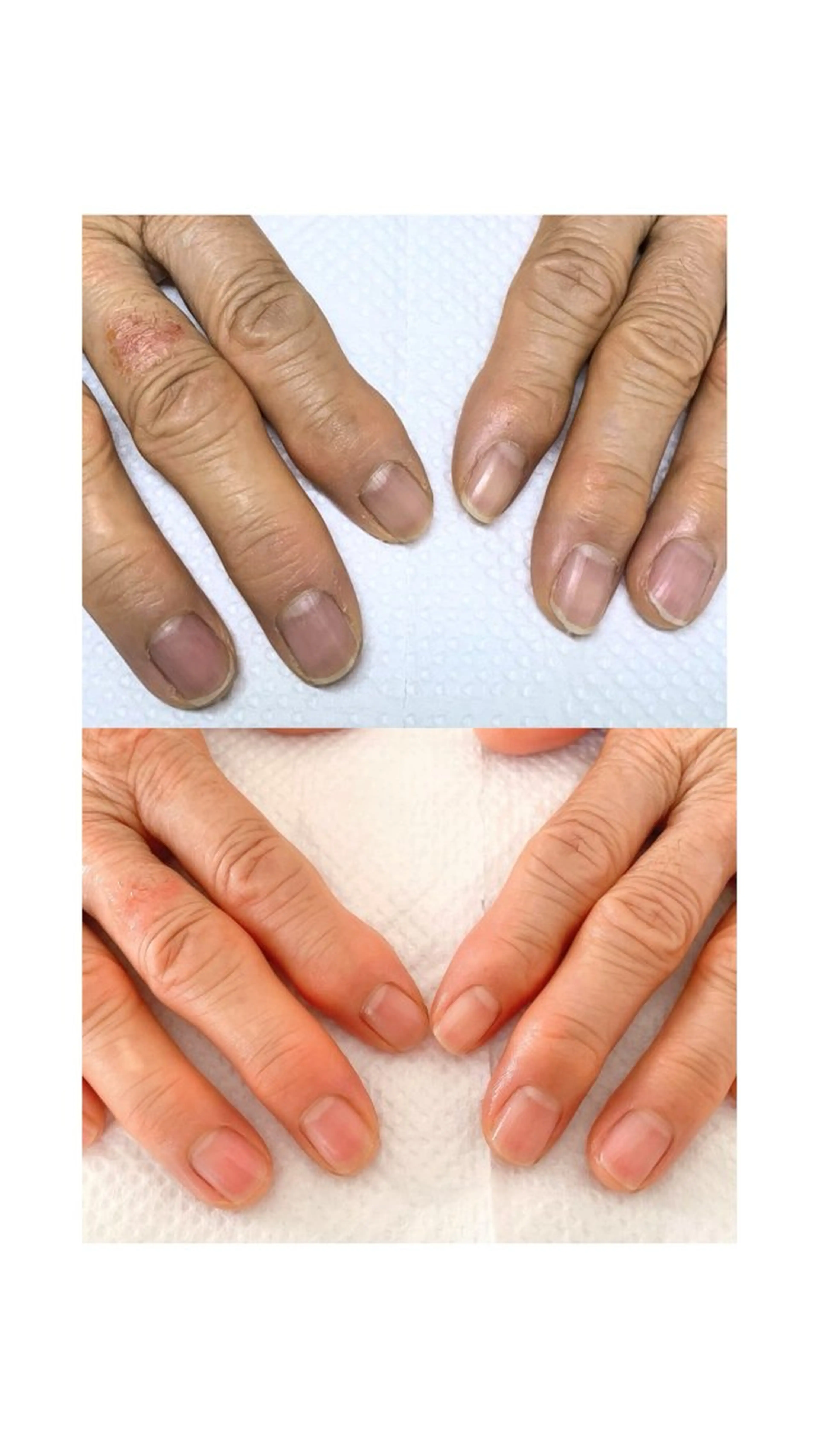 ネイル Alo.nail アロ•ネイルのネイルデザイン