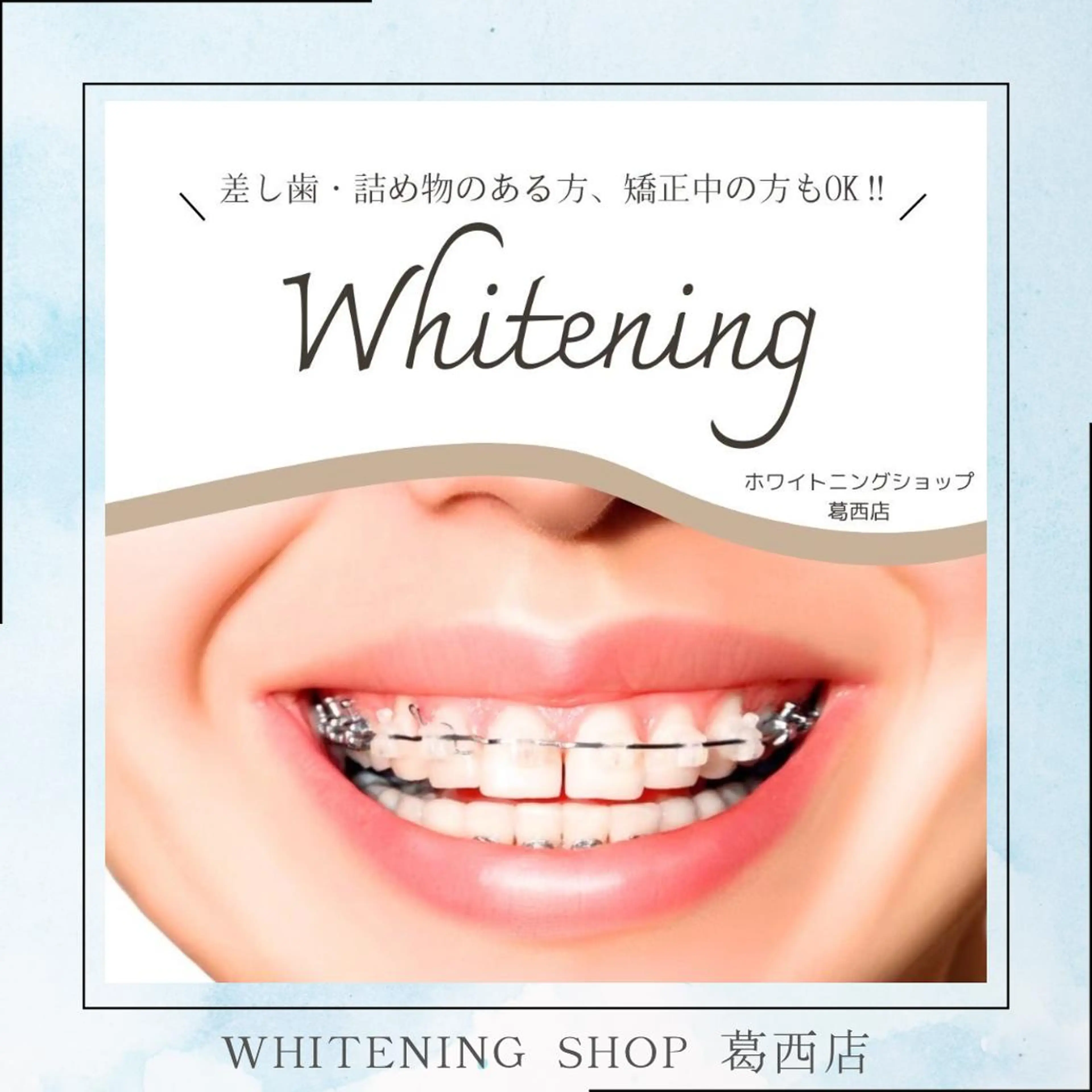 メンズ その他 ホワイトニング ショップ葛西店のその他イメージ