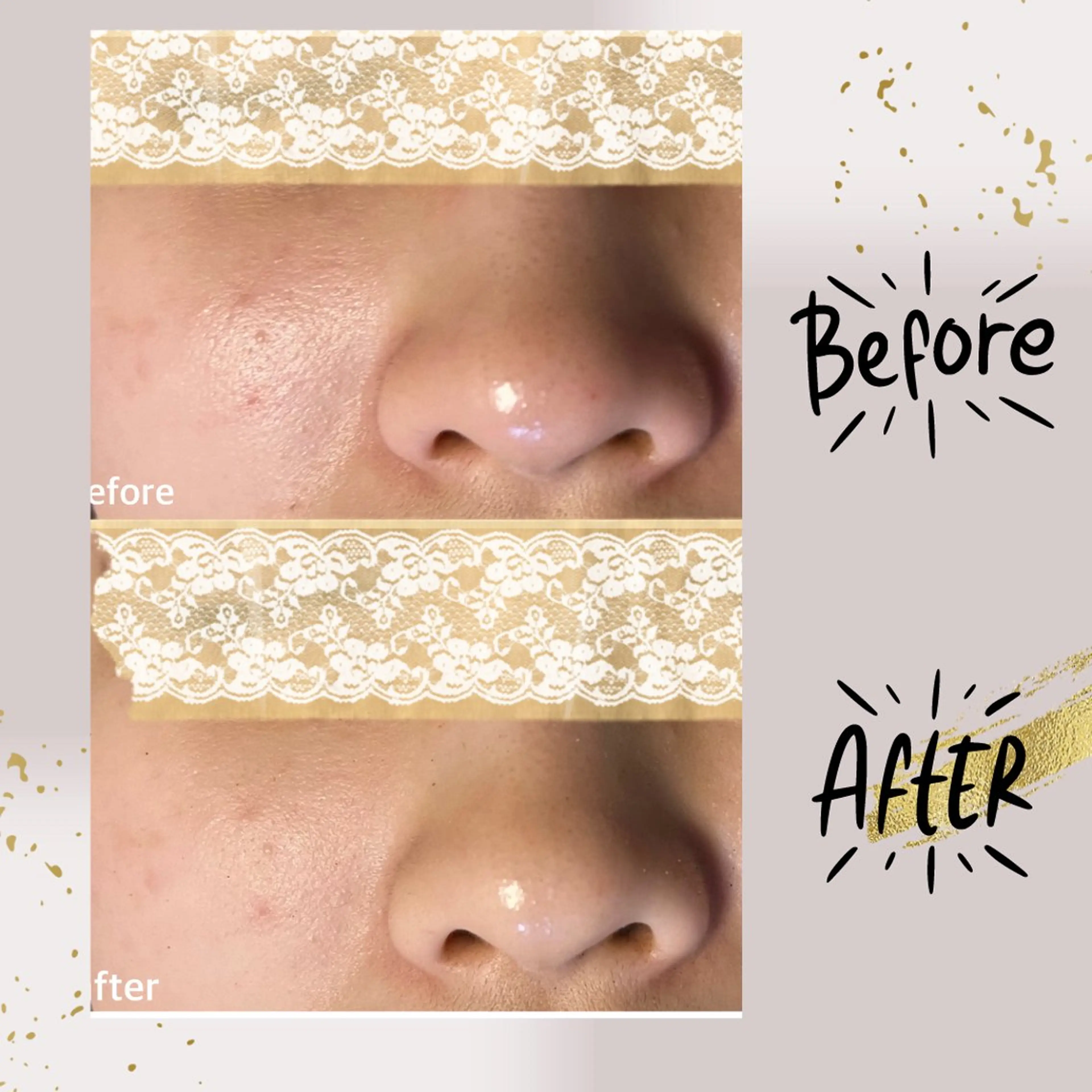 エステ リラク ピーリング専門店 Belluteのエステ・リラクイメージ