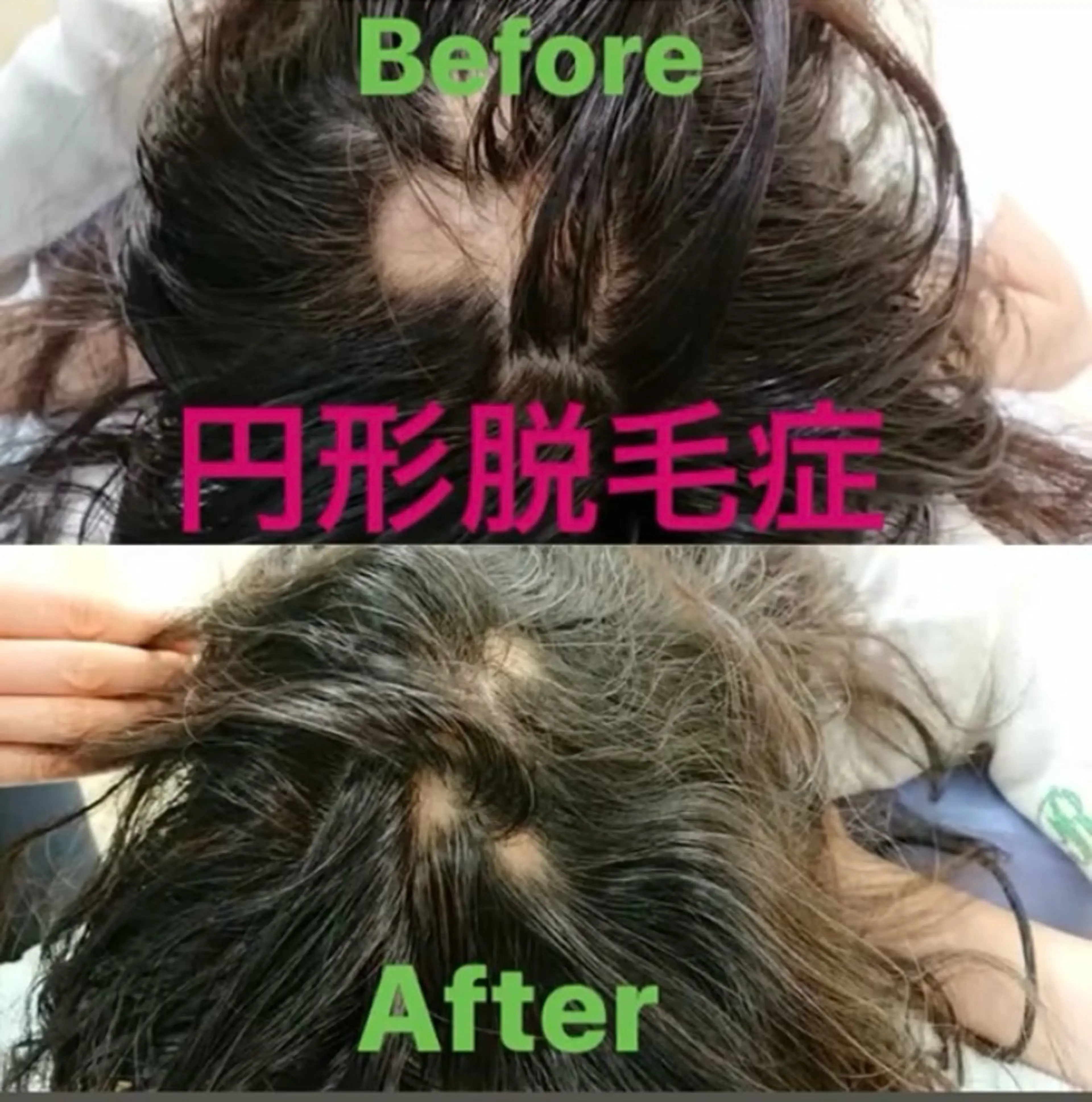 撮影モデル セレブリボーンパッシブタウン　プレミア所属・目澤 幸代のエステ・リラクイメージ