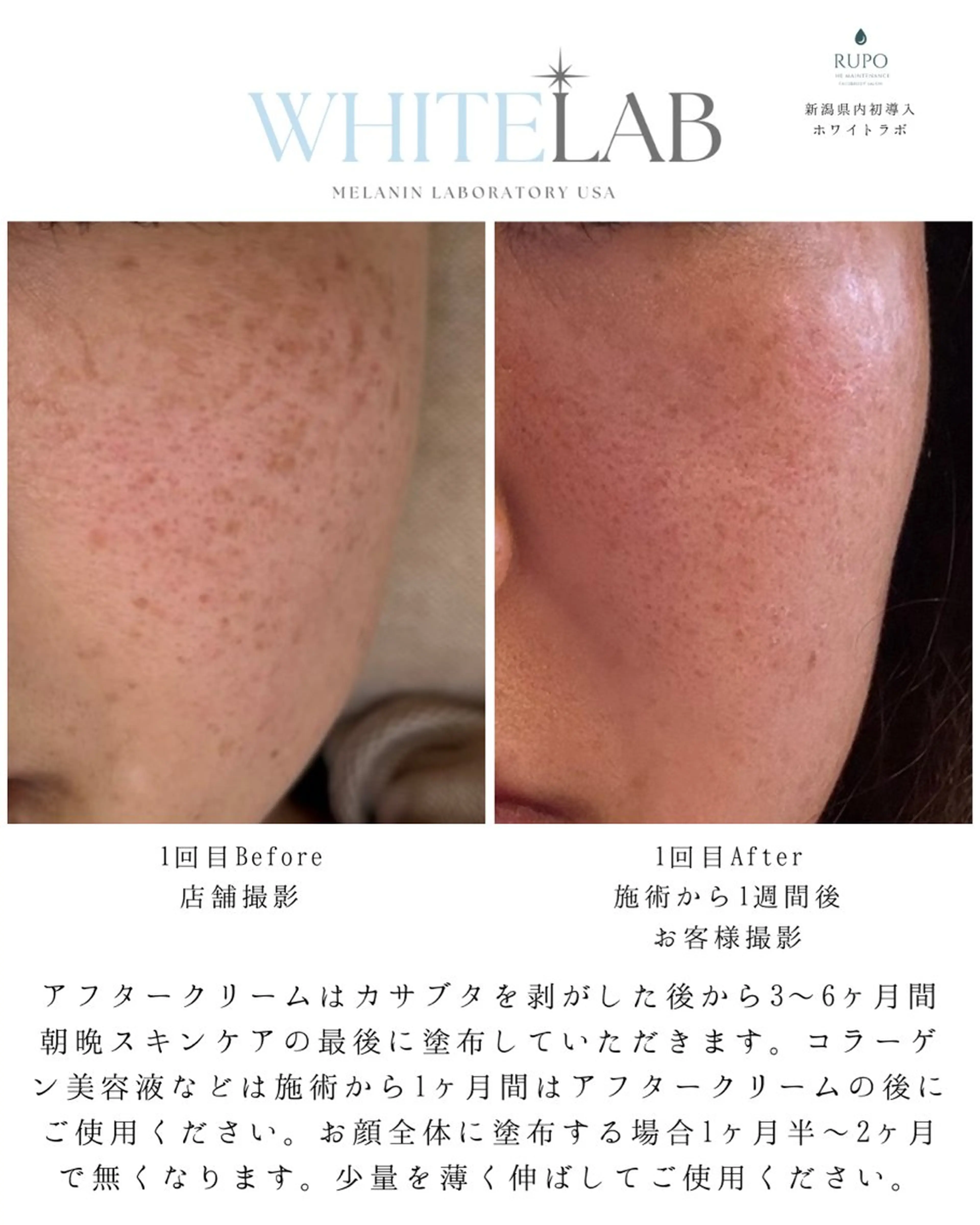 RUPO THE MAINTENANCE新潟店【ローマピンク公式認定店/ララピール正規店/骨格小顔】所属・オーナー Nanjoのエステ・リラクイメージ