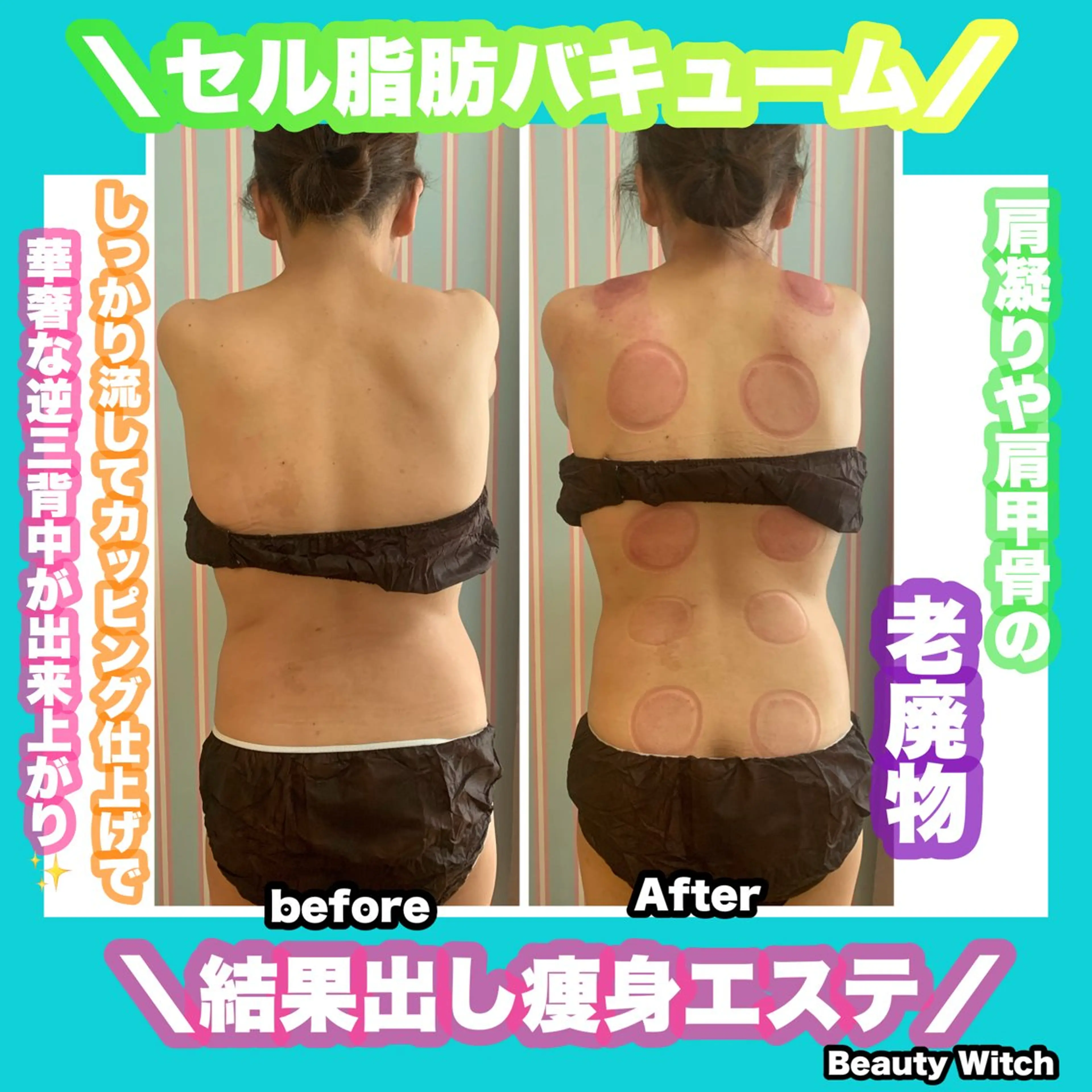 エステ 痩身/脱毛/ネイル HARUKAのエステ・リラクイメージ