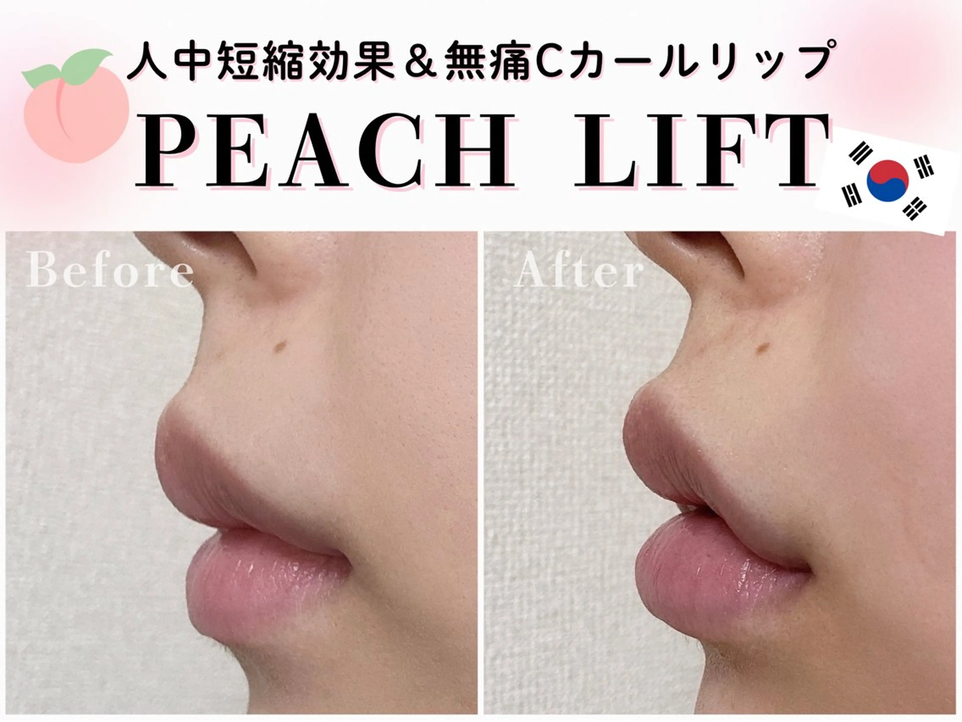 HETIY by Seoul所属・韓国肌管理🇰🇷 水光肌/肌質改善🫧のエステ・リラクイメージ