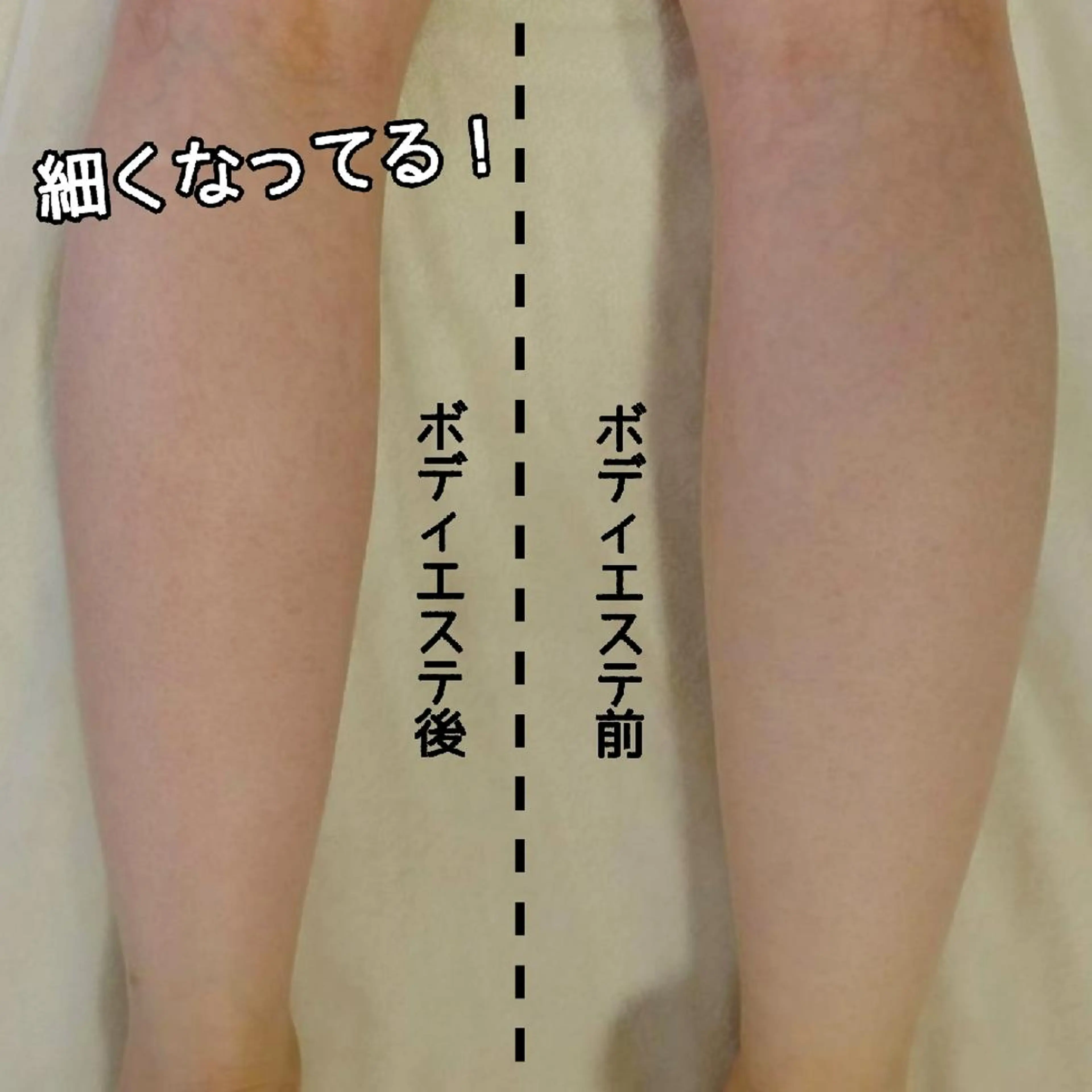 ミニモ限定！💓ボディケア品詰め合わせプレゼント付き🎁フットバス&レッグ(つま先～太ももまでの)マッサージ🦶✨の写真