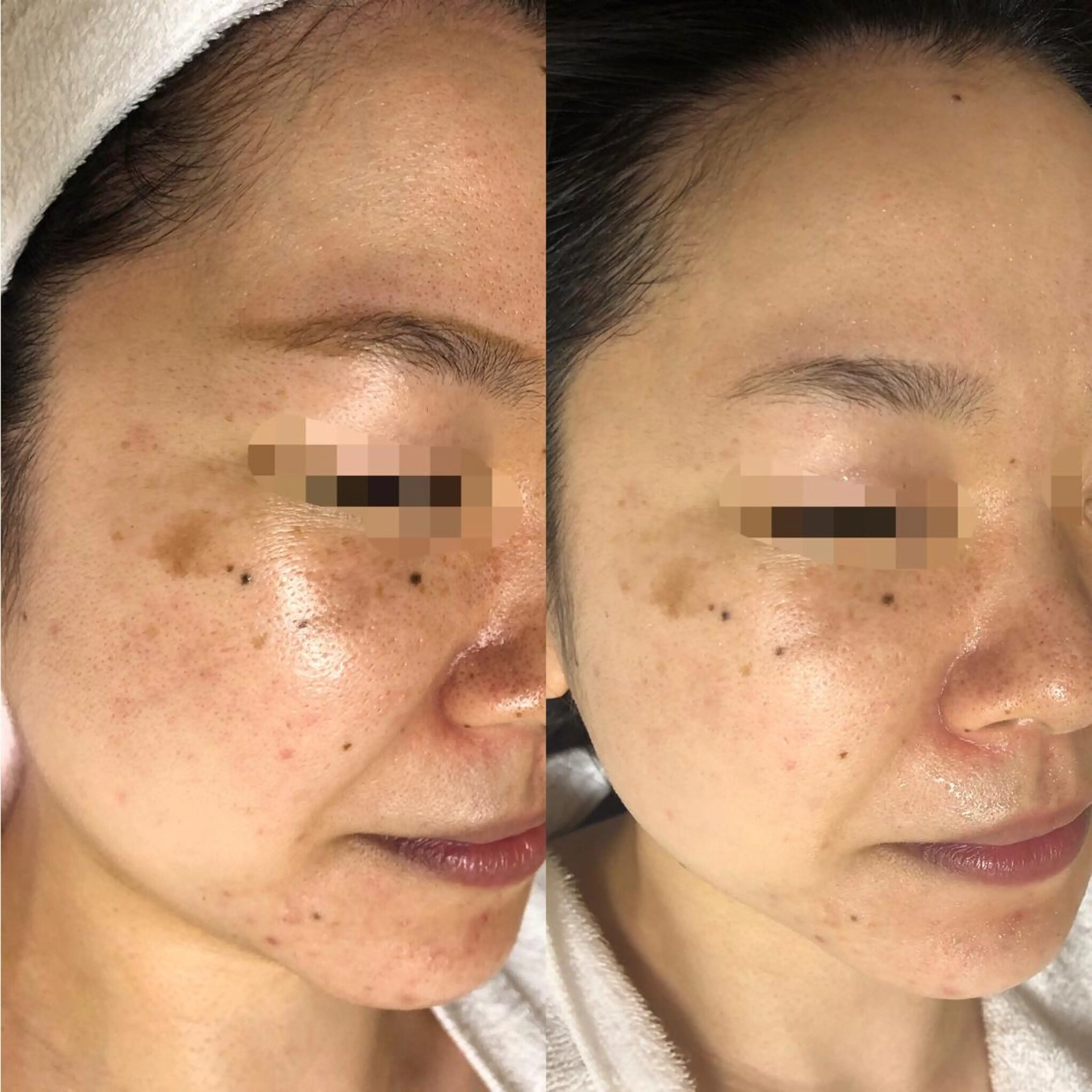 エステ エスカル ボーテのエステ・リラクイメージ