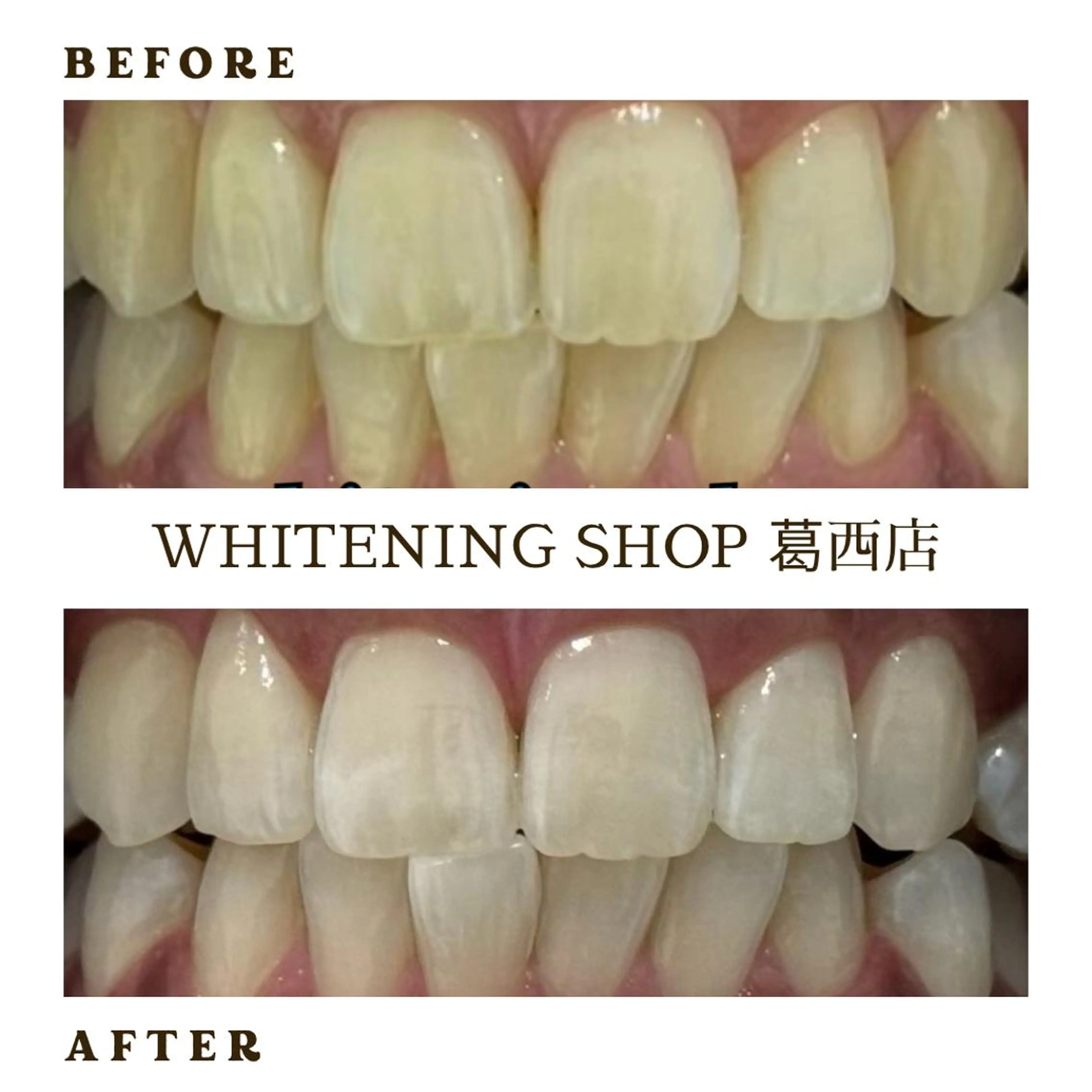 メンズ その他 ホワイトニング ショップ葛西店のその他イメージ