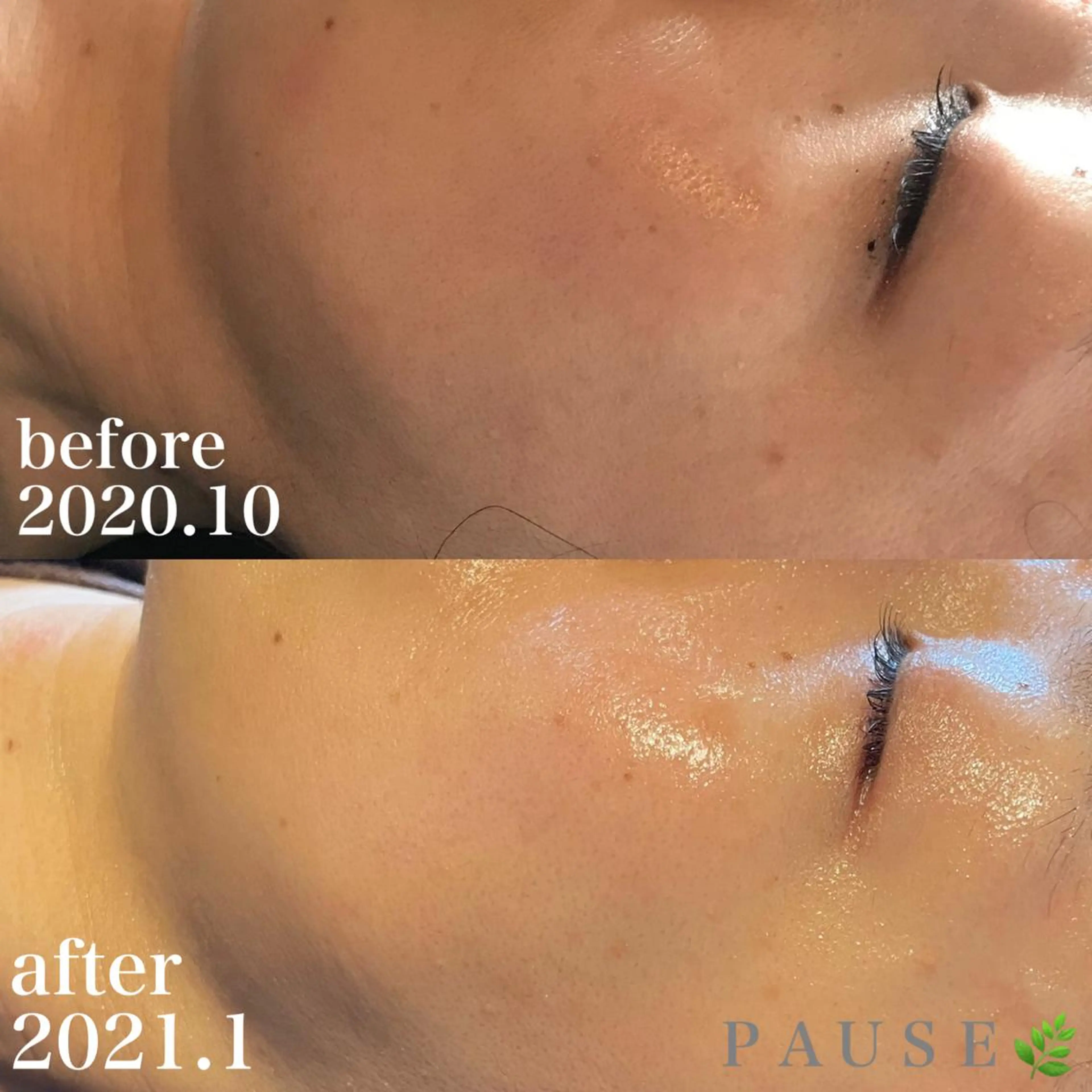 エステ 浜野 恵美のエステ・リラクイメージ