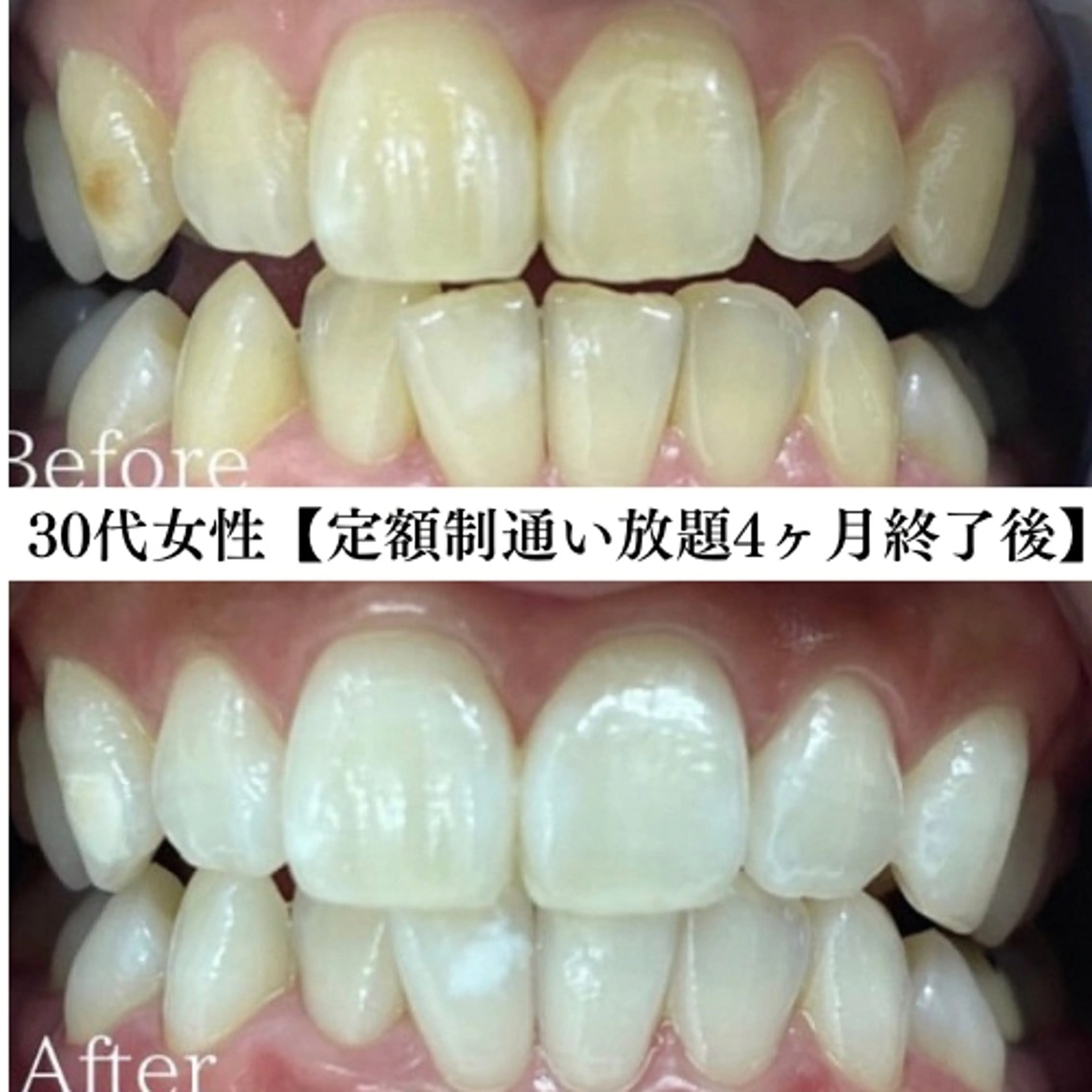 キッズ メンズ エステ リラク セルフホワイトニング専門店WHITE福岡天神店所属・セルフホワイト専門店 WHITE福岡天神店のエステ・リラクイメージ