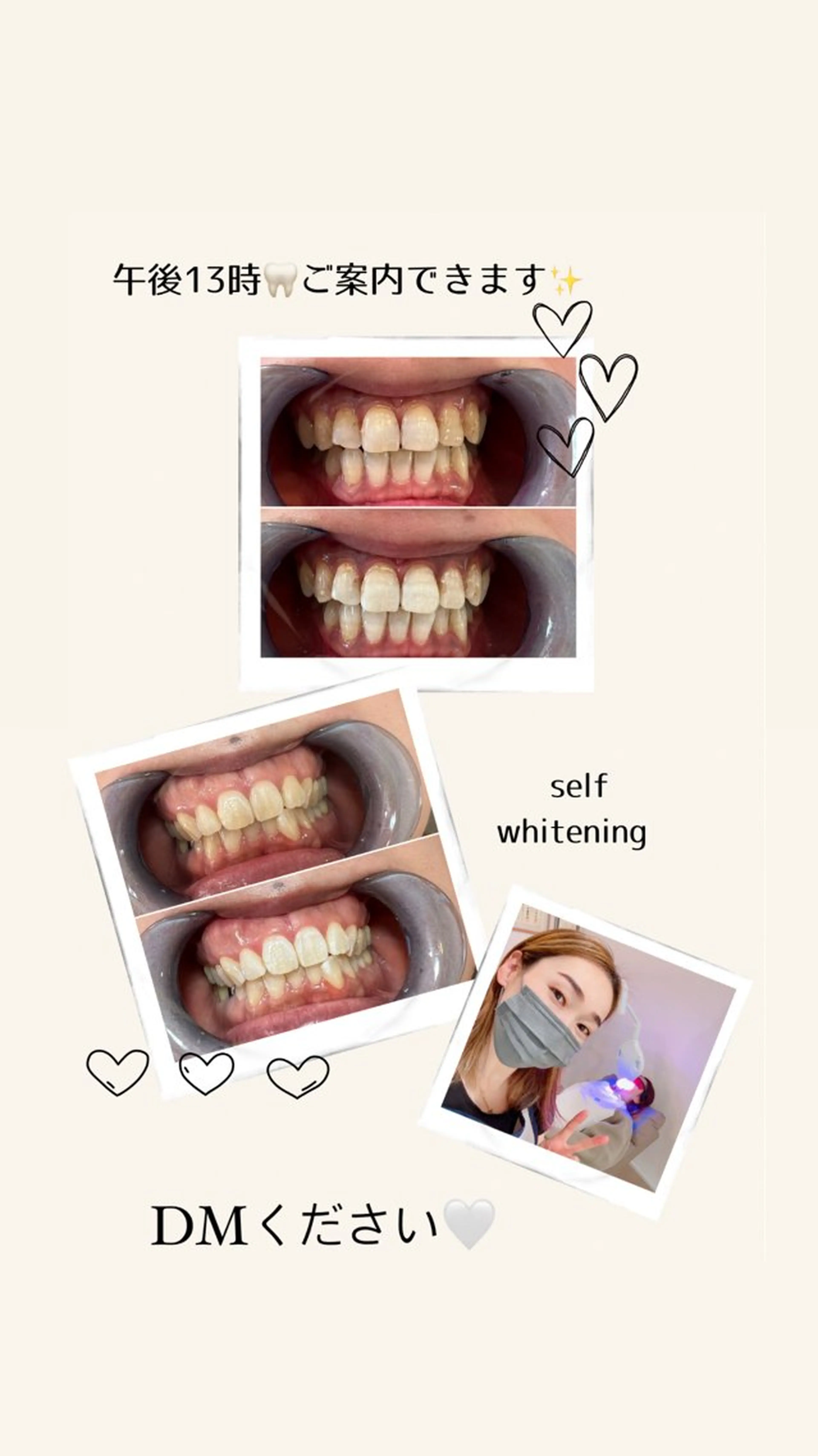 セルフホワイトニング Shineeのエステ・リラクイメージ