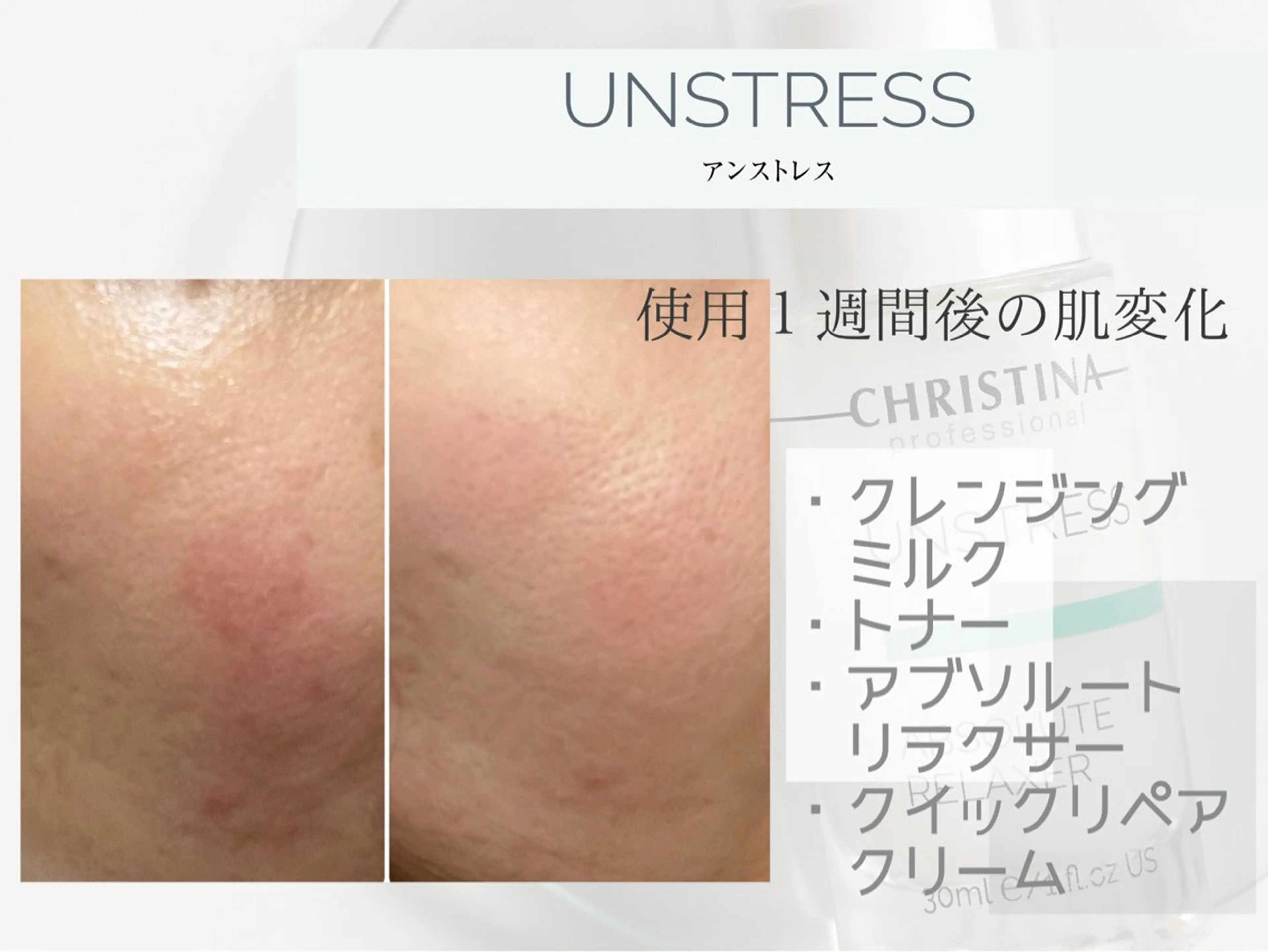 肌質改善|天王寺 For...はるかのエステ・リラクイメージ