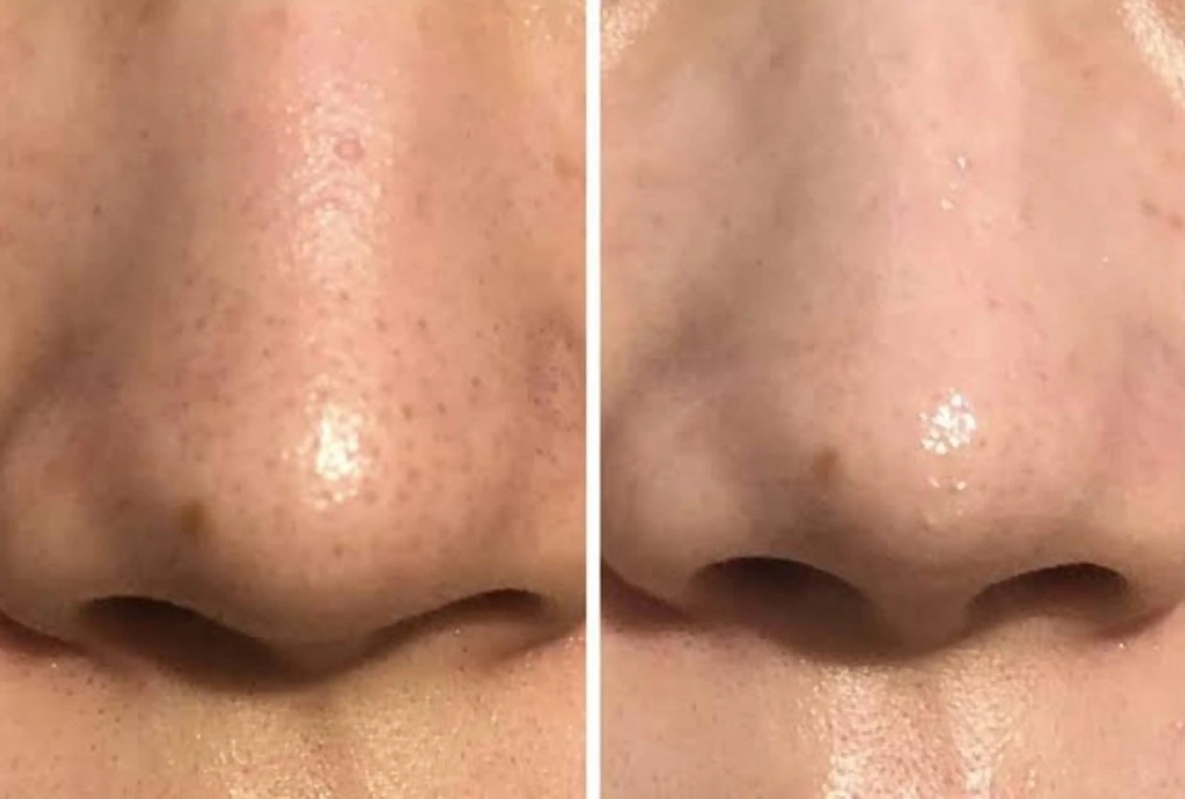 最速小顔・肌質管理 ❣️エスポワールのエステ・リラクイメージ