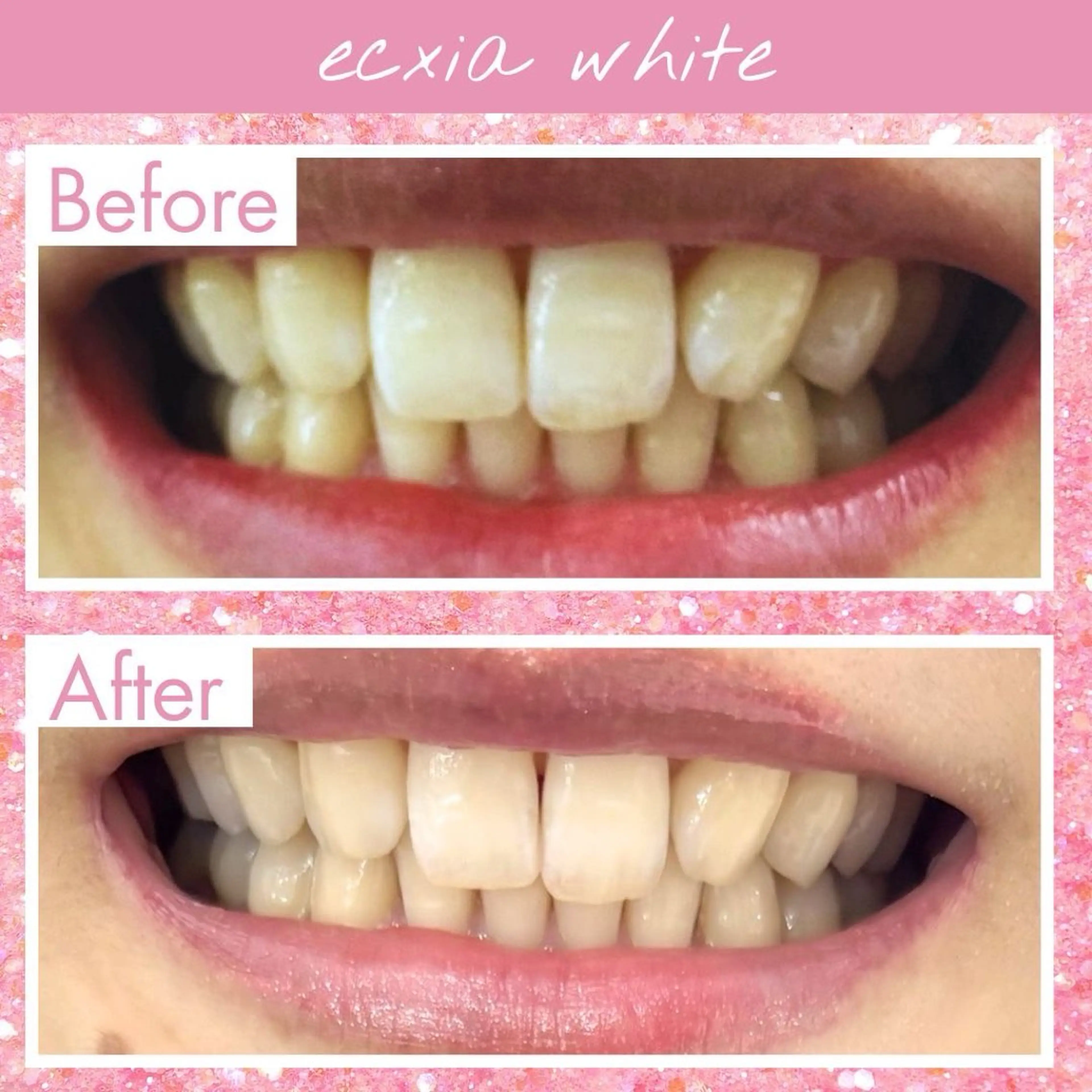 エクシア仙台駅東口店所属・セルフホワイトニング エクシア仙台駅東口店のその他イメージ