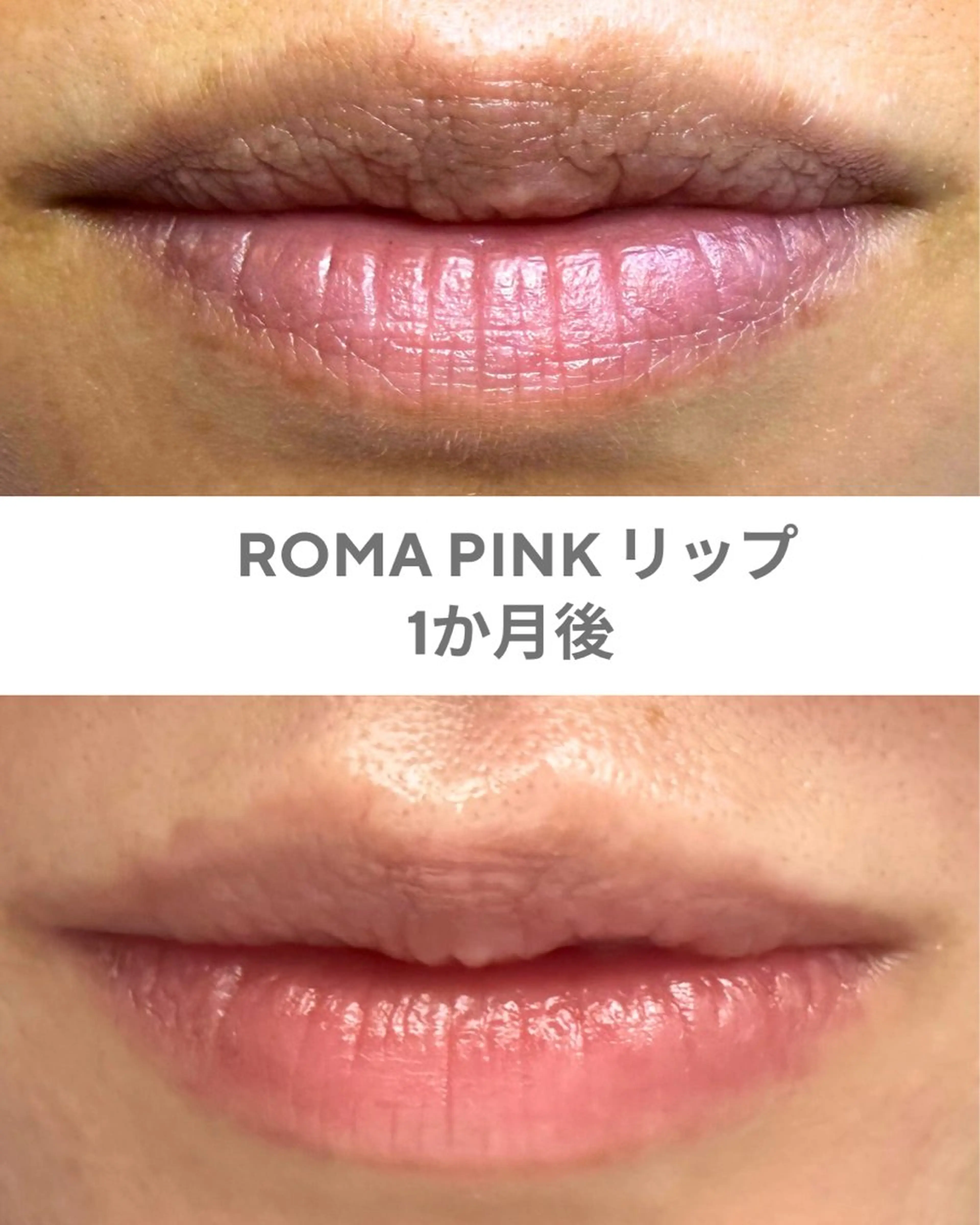 エステ GrandAzure 大人の肌改善のエステ・リラクイメージ