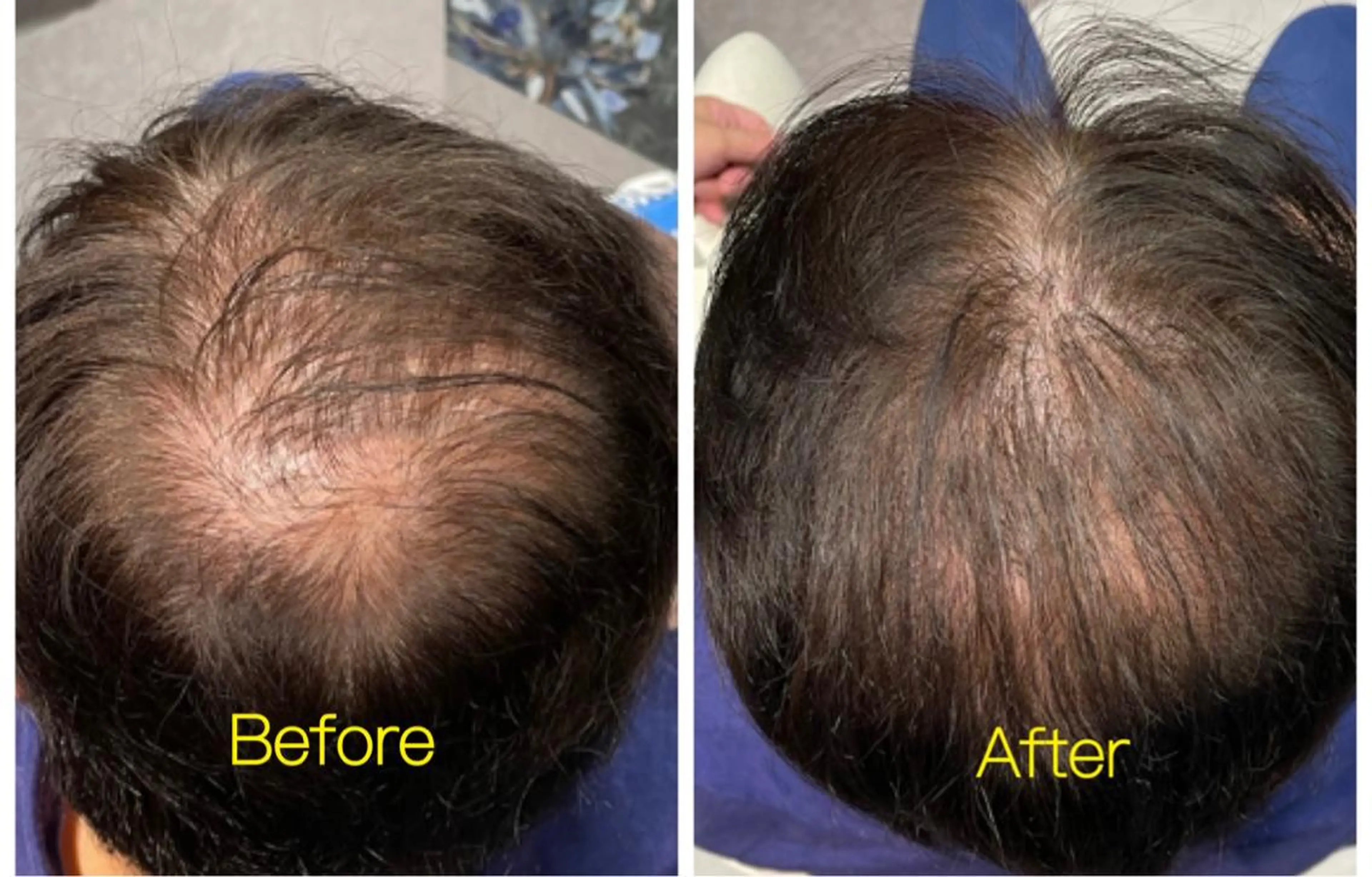 ショート ヘアアレンジ メンズ Kanal Kanaのエステ・リラクイメージ