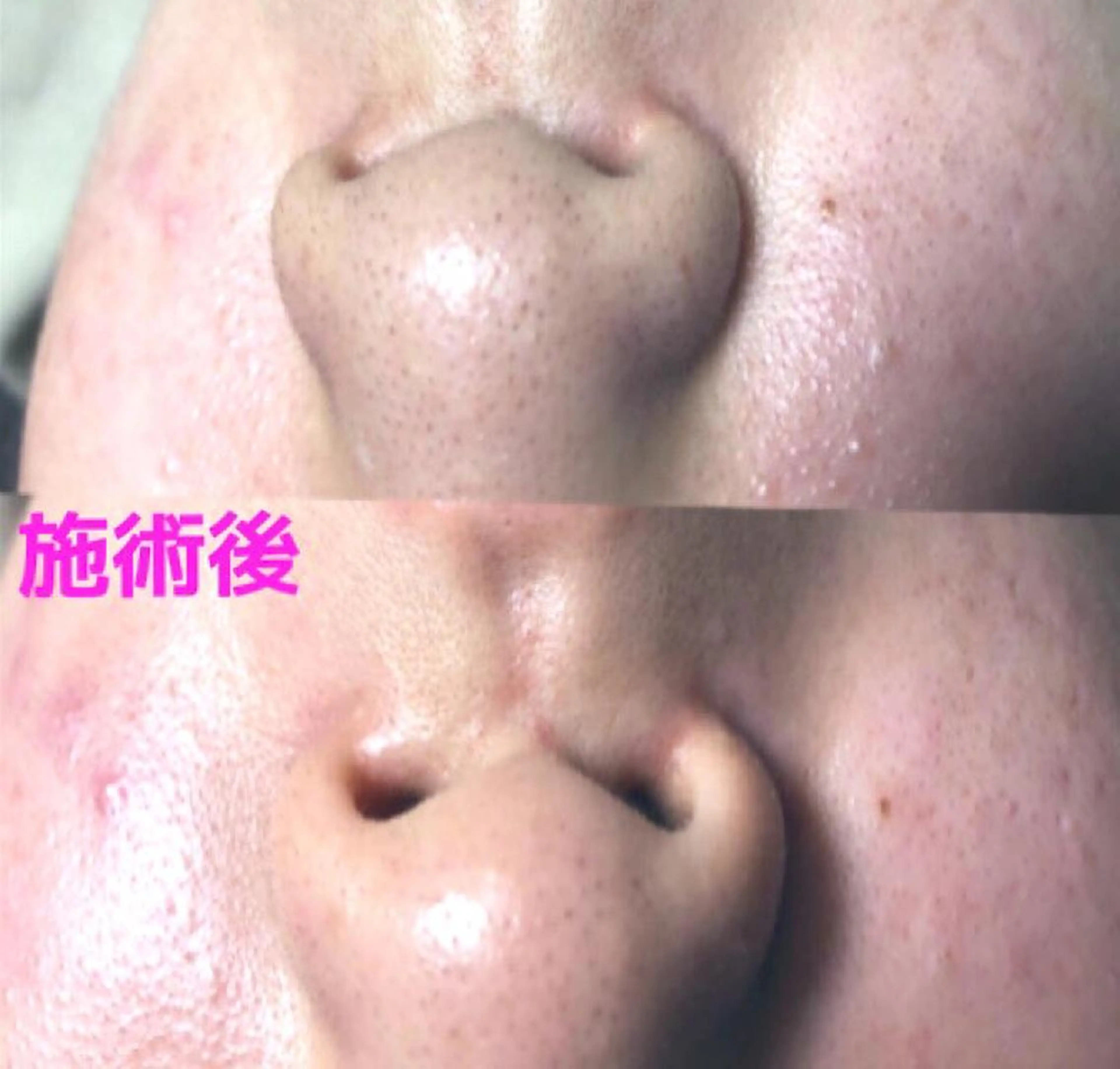 エステ La.pport ラポールのエステ・リラクイメージ