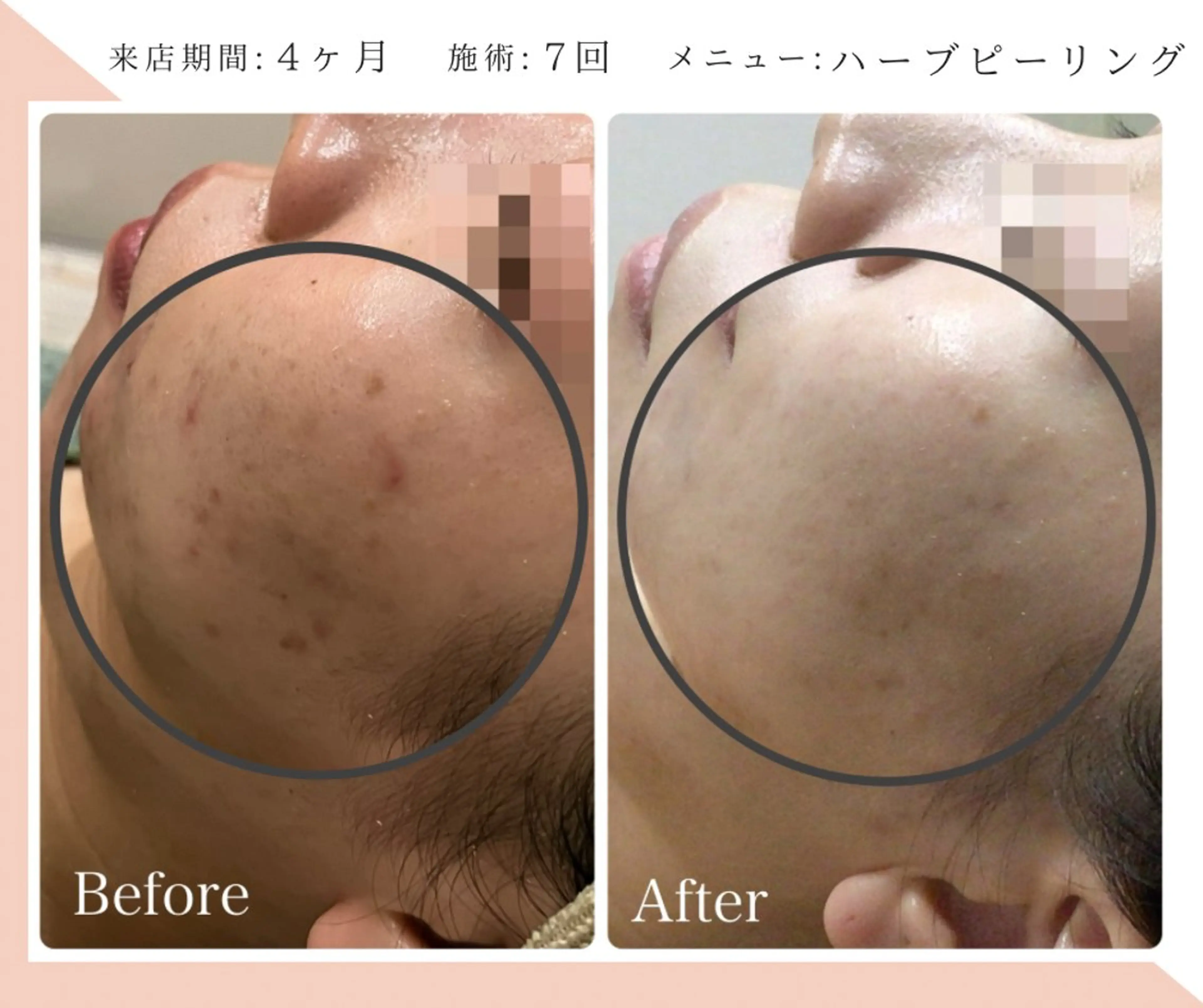 脱毛&フェイシャル 専門店muro.のエステ・リラクイメージ