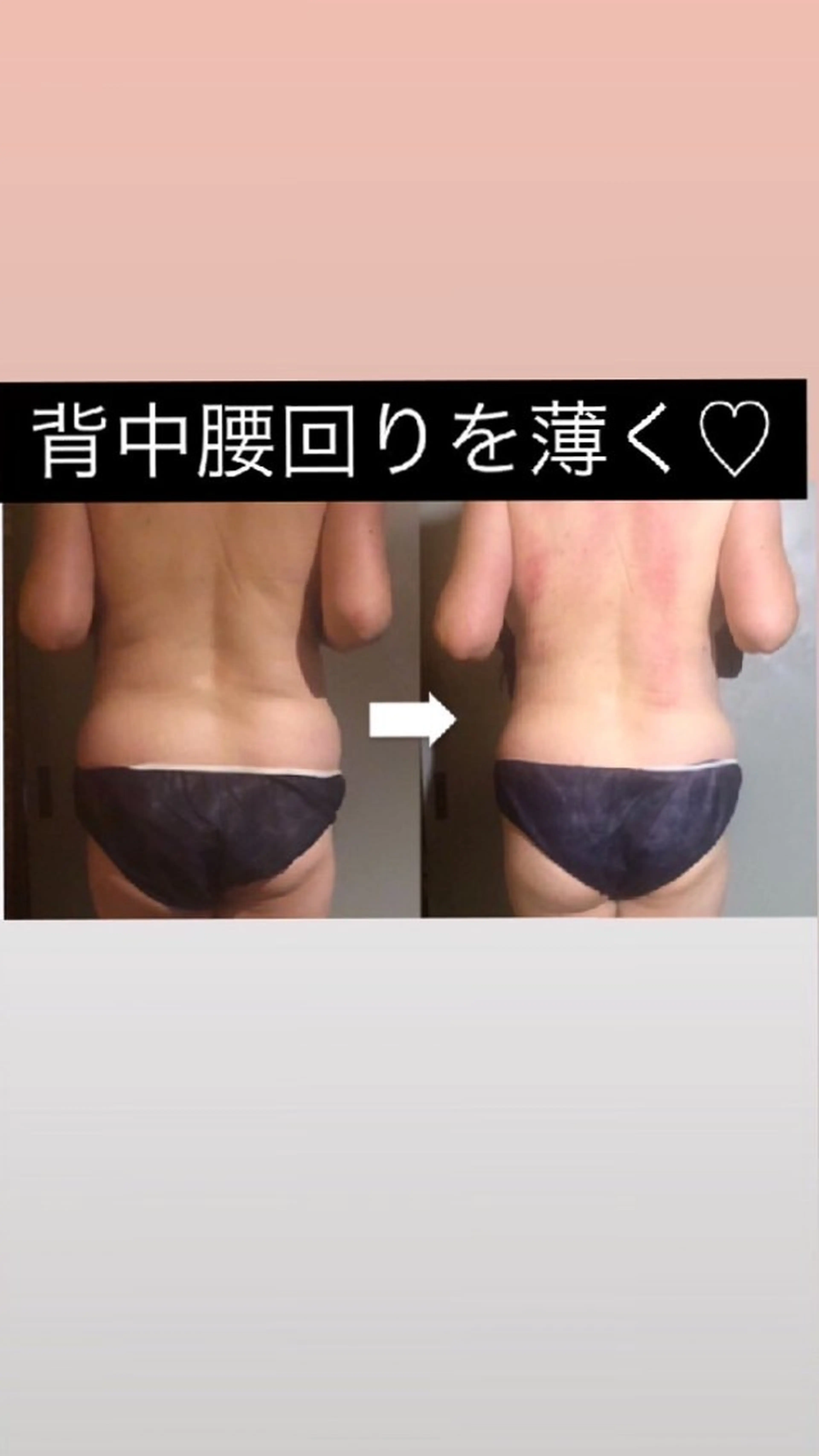 越谷小顔痩身サロン南国‐蒼‐ao所属・南国‐蒼あお‐ ビューティーサロンのその他イメージ