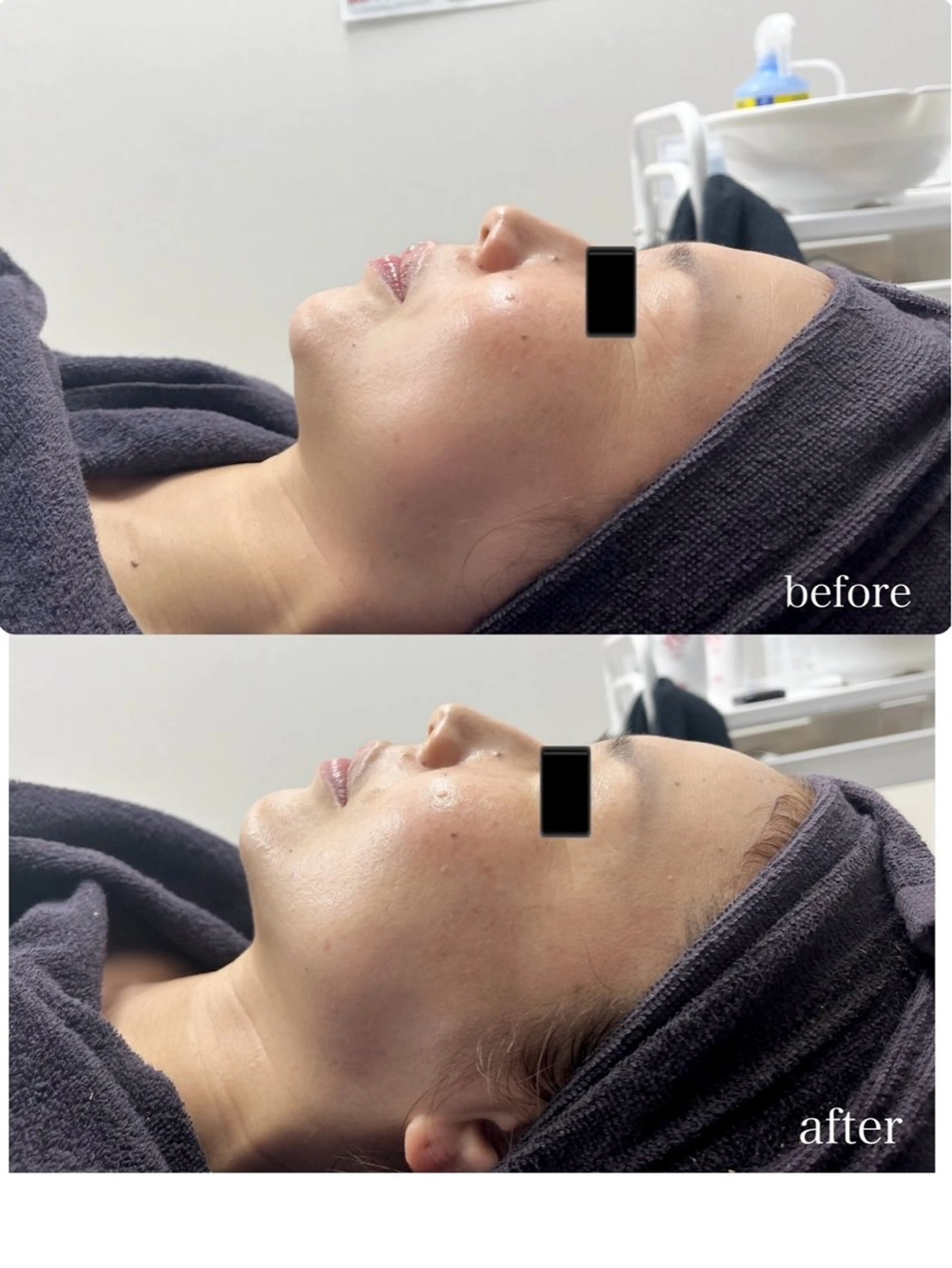 Genesis Plus大津京店のエステ・リラクイメージ