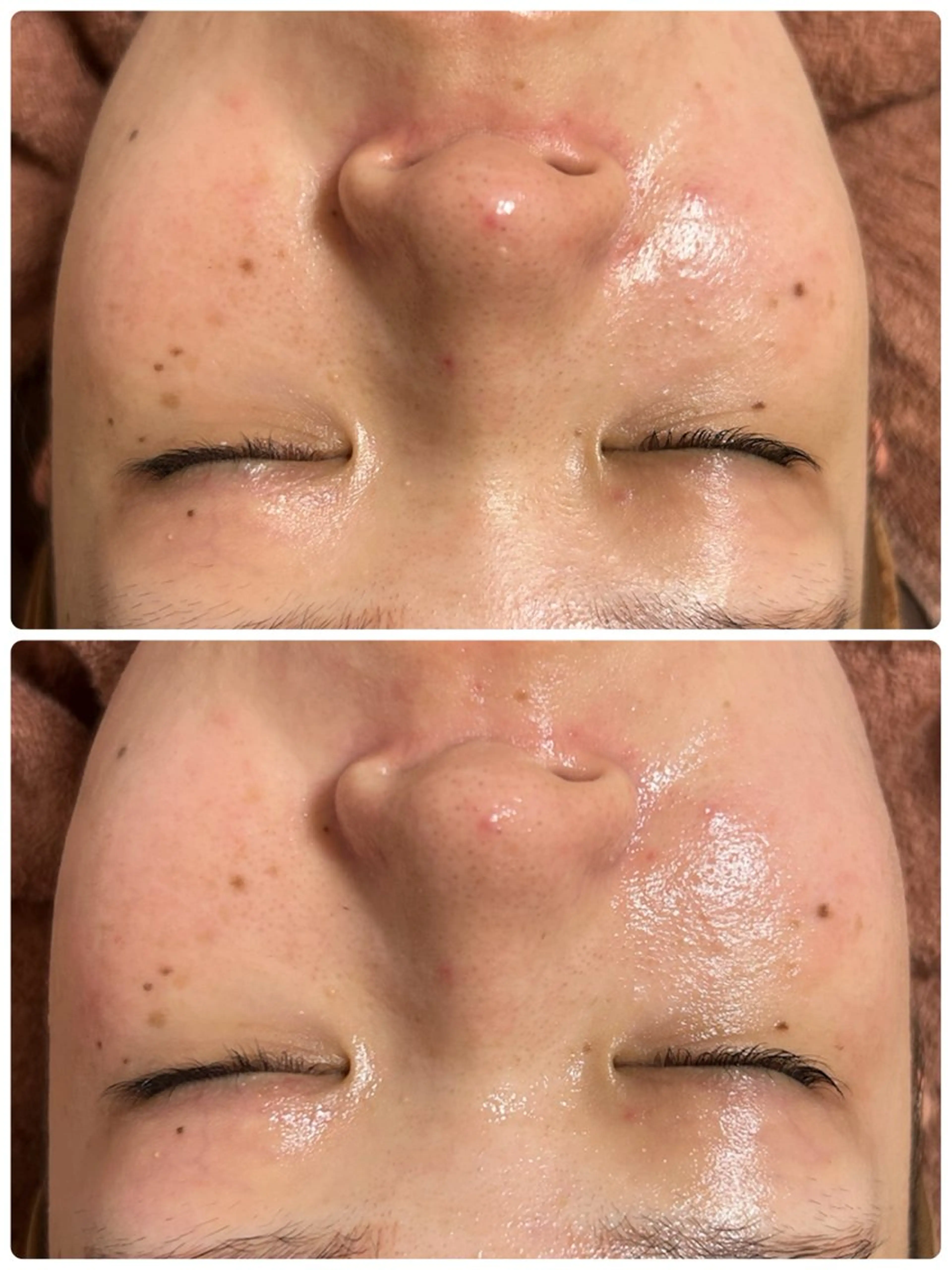 エステ 艶肌/角質ケア フェイシャルワックスのエステ・リラクイメージ