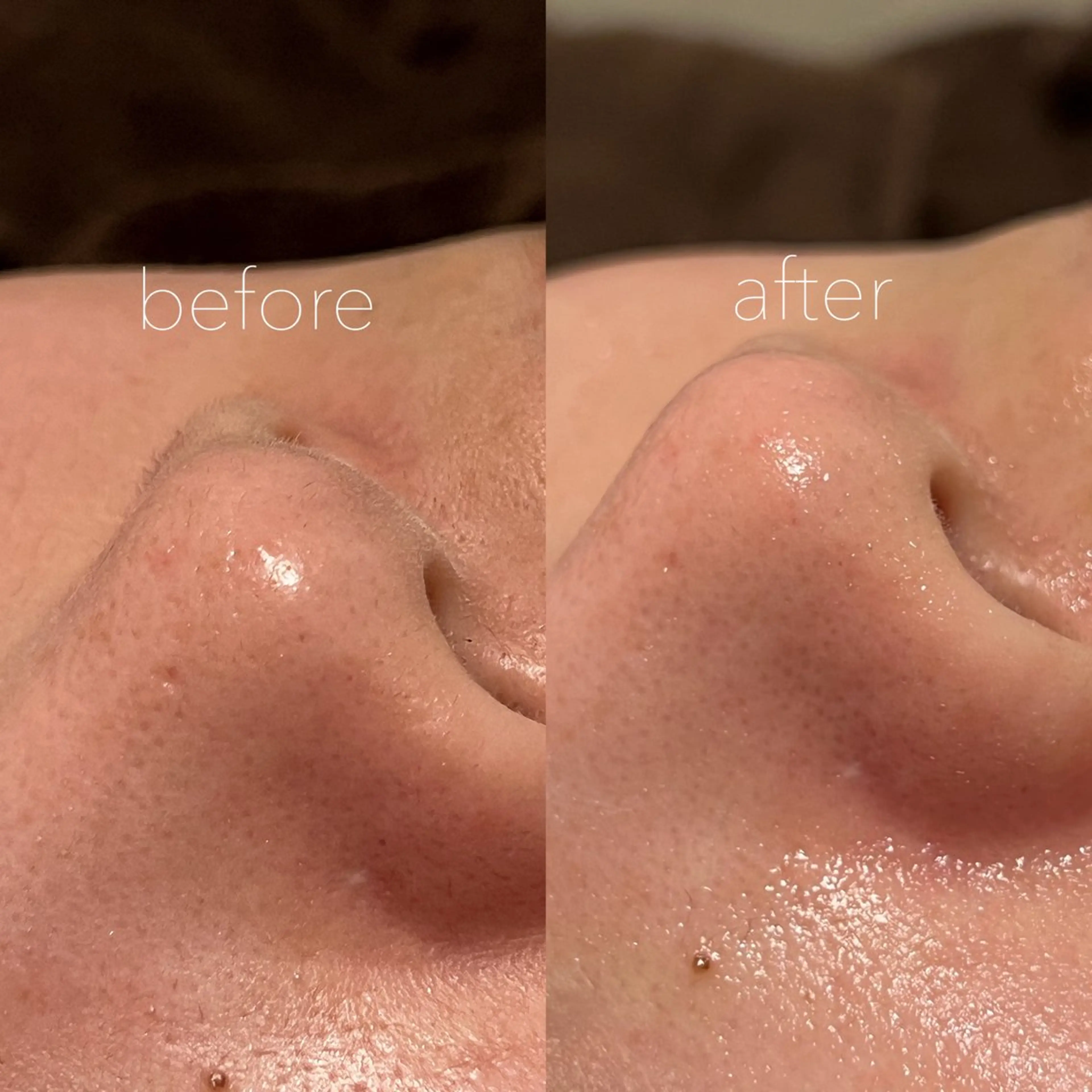 眉毛×肌質改善🫧 高岳/新栄町✨YUUの眉毛・アイブロウイメージ