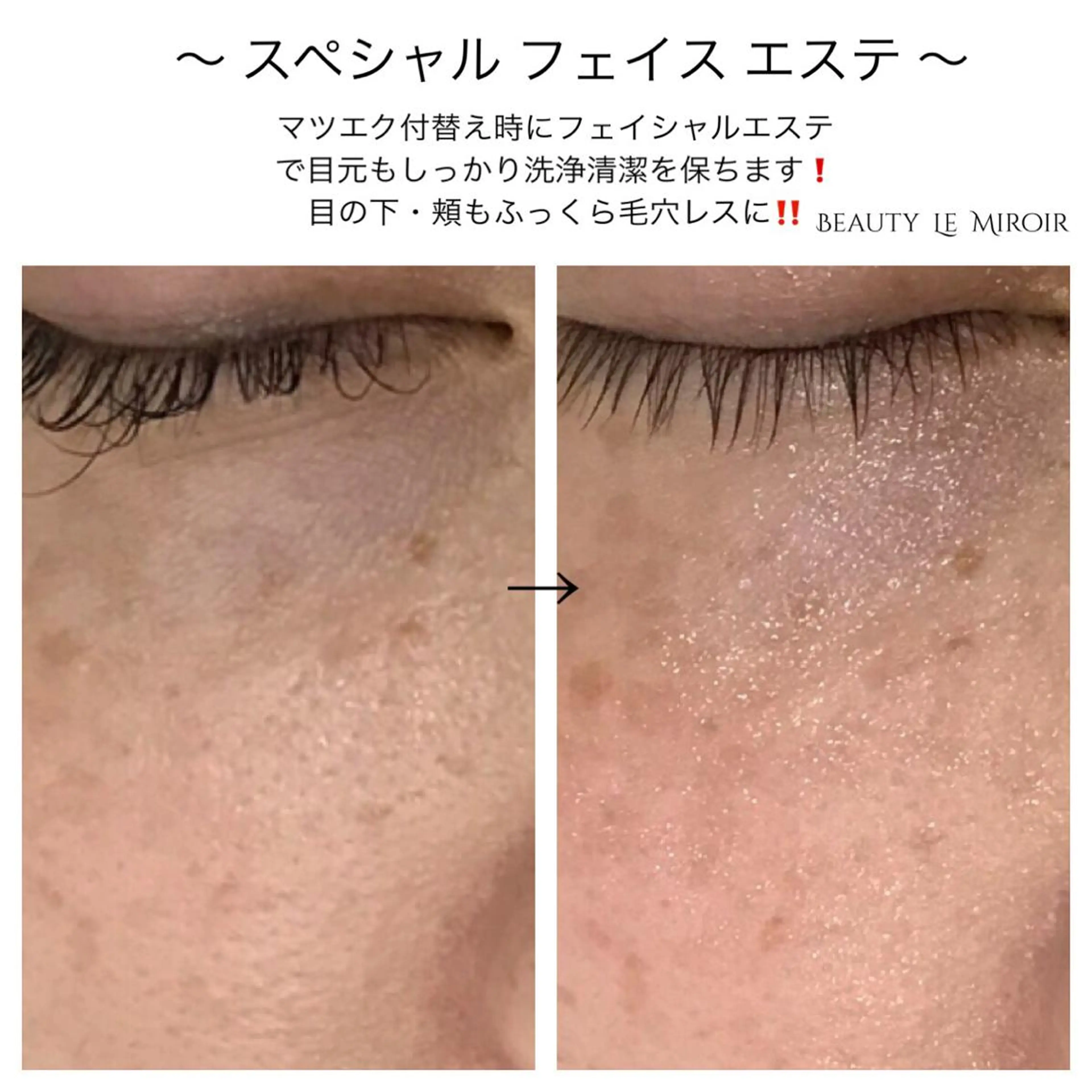 マツエク・マツパ ビューティー ミロワールのエステ・リラクイメージ