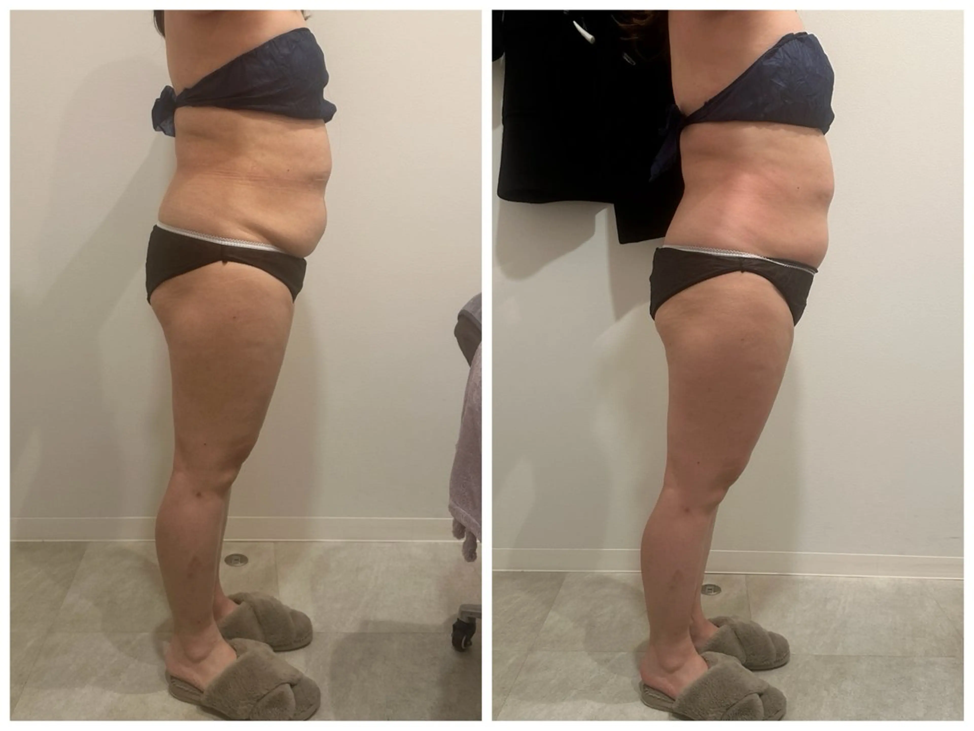 エステ 桜新町 Sakurakoのエステ・リラクイメージ