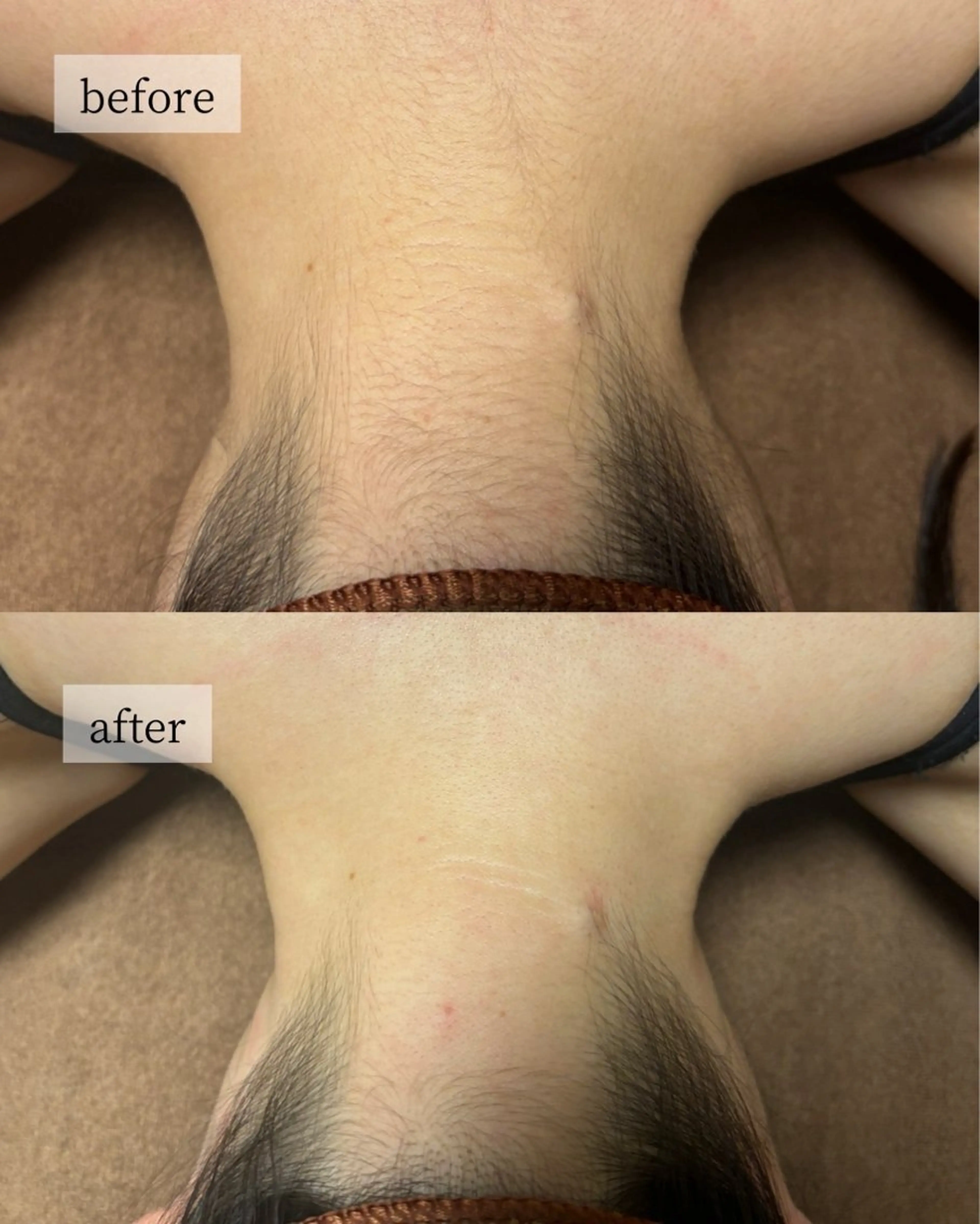 HINANO矢場町店【ヒナノ】所属・脱毛/肌改善🌿 HINANO 村田のエステ・リラクイメージ