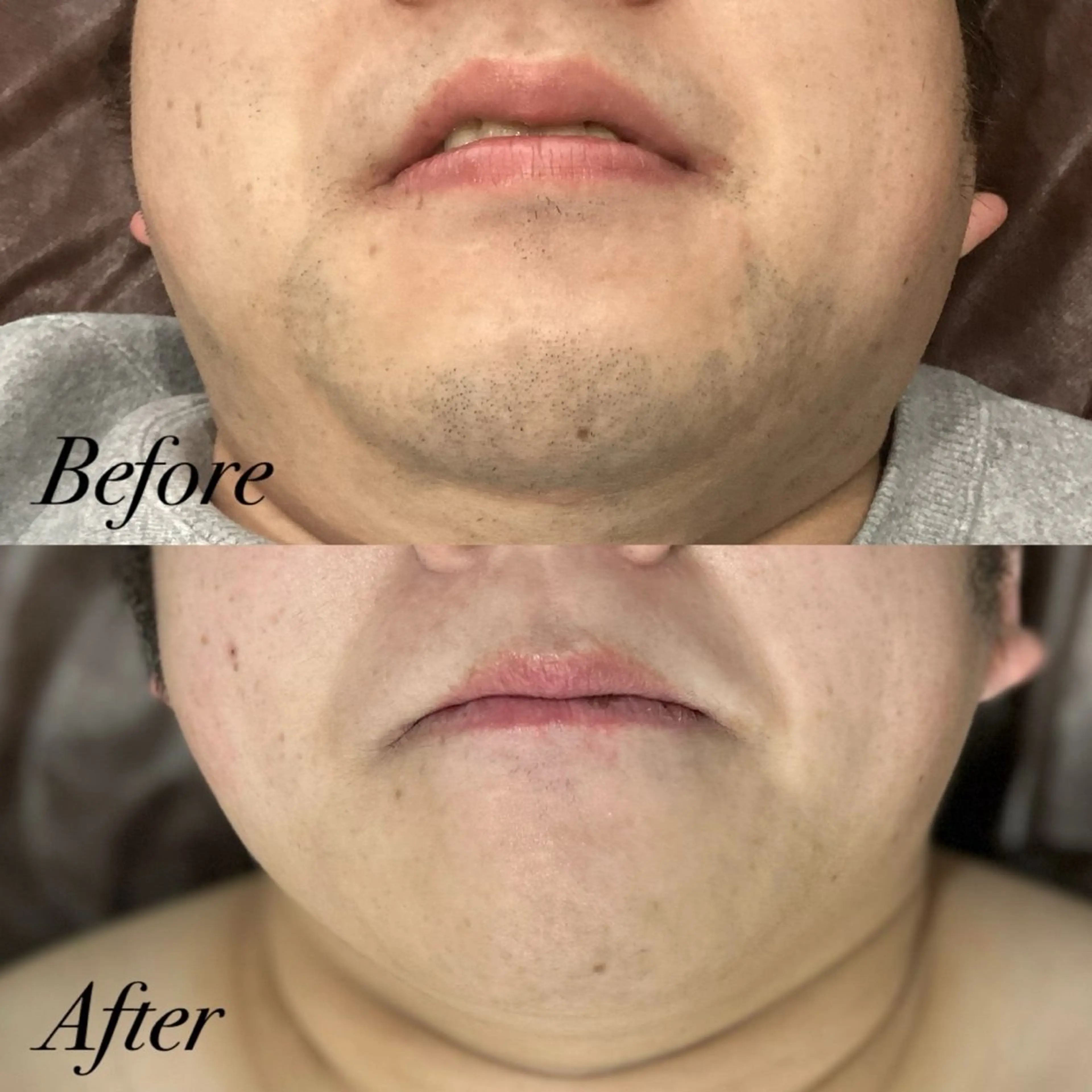 メンズ 脱毛 脱毛／眉毛 BOSS 森山晴都の眉毛・アイブロウイメージ