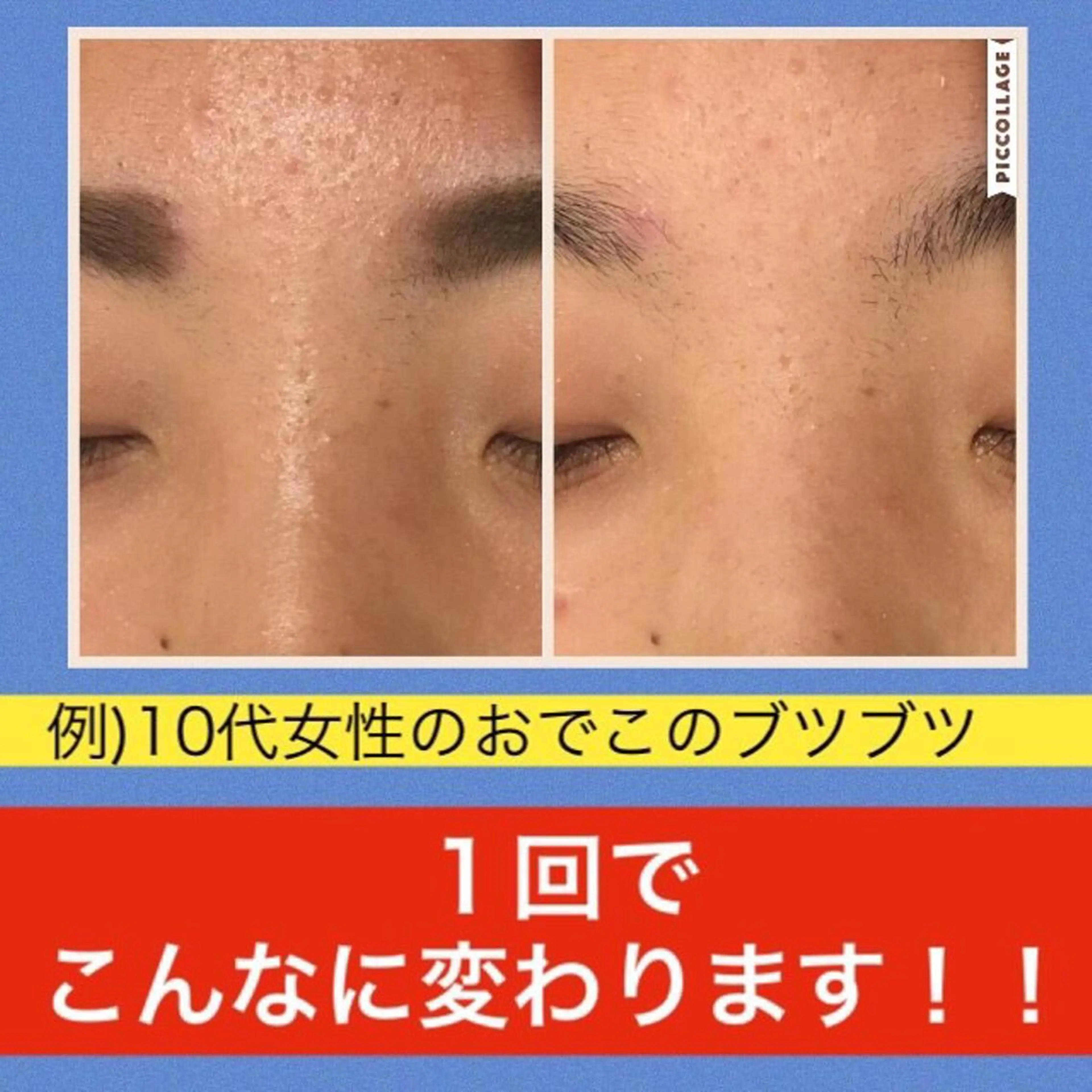 ミディアム カラー パーマ ヘアアレンジ メンズ キッズ ネイル マツエク・マツパ ニキビ・肌質改善専門 ♡人生が変わるサロンのエステ・リラクイメージ