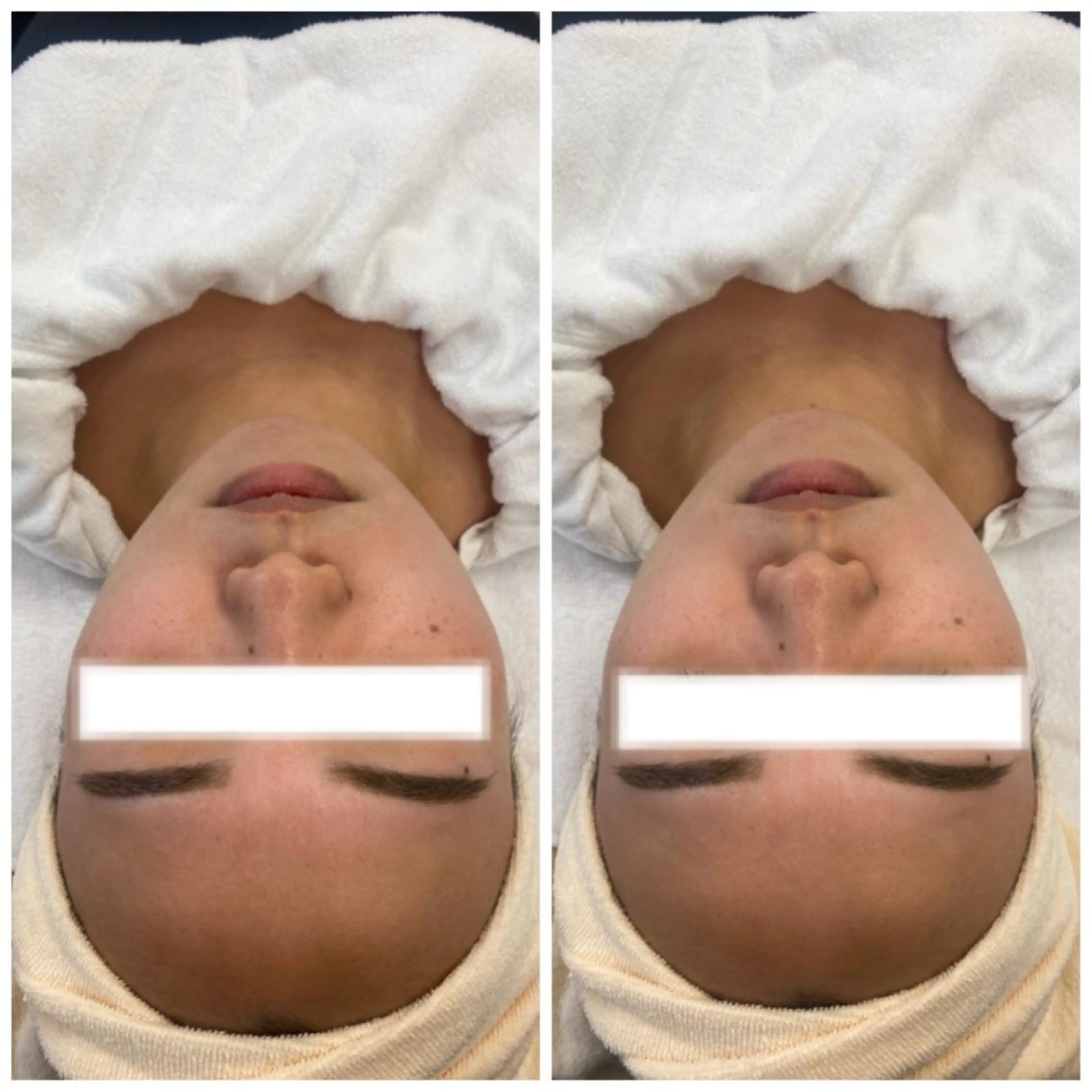 ネイル マツエク・マツパ アイブロウ 肌質改善美容サロン ému 用賀のエステ・リラクイメージ