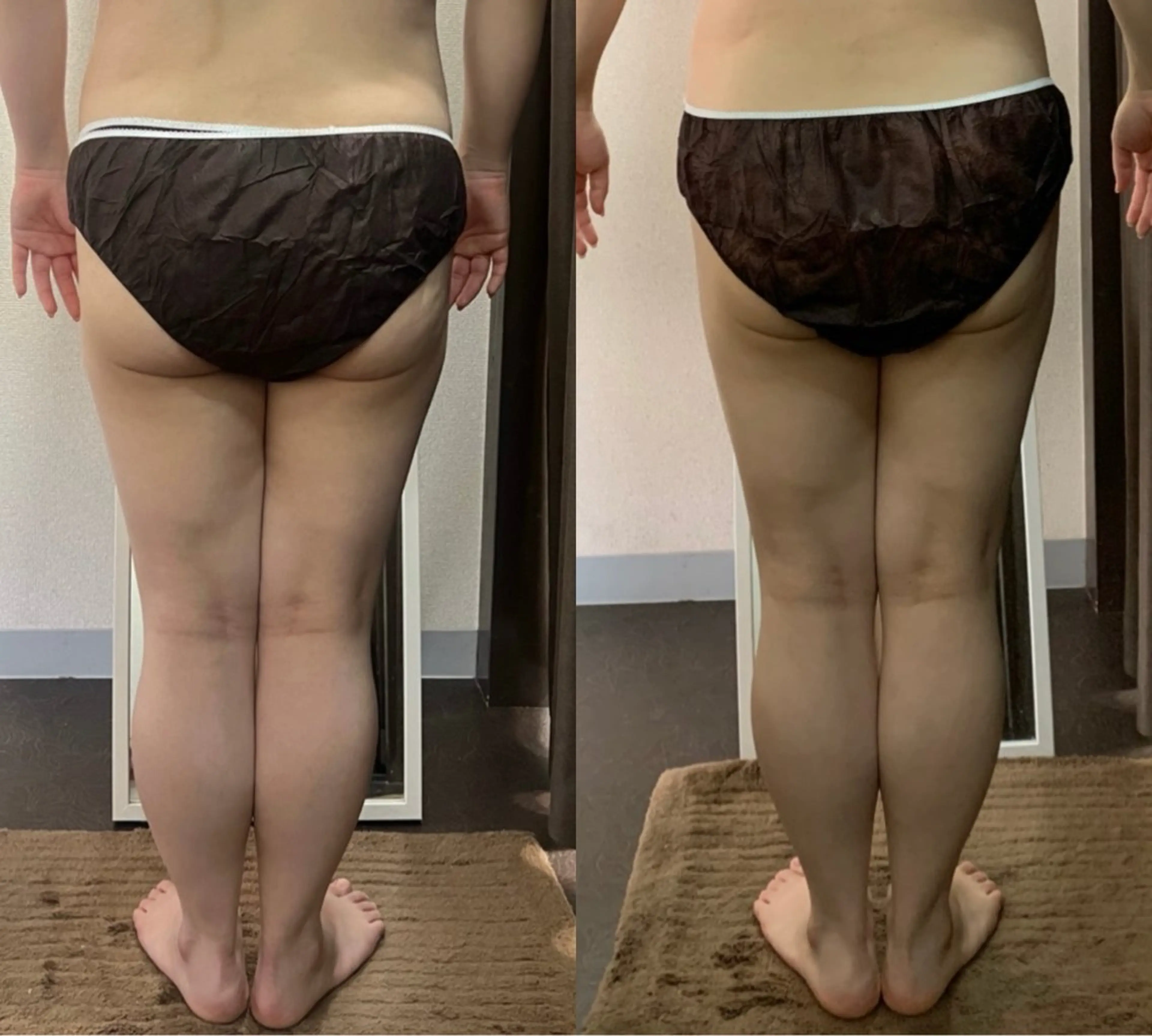 ハイパーナイフ専門店　Salon de COCO所属・Salon de COCOのエステ・リラクイメージ